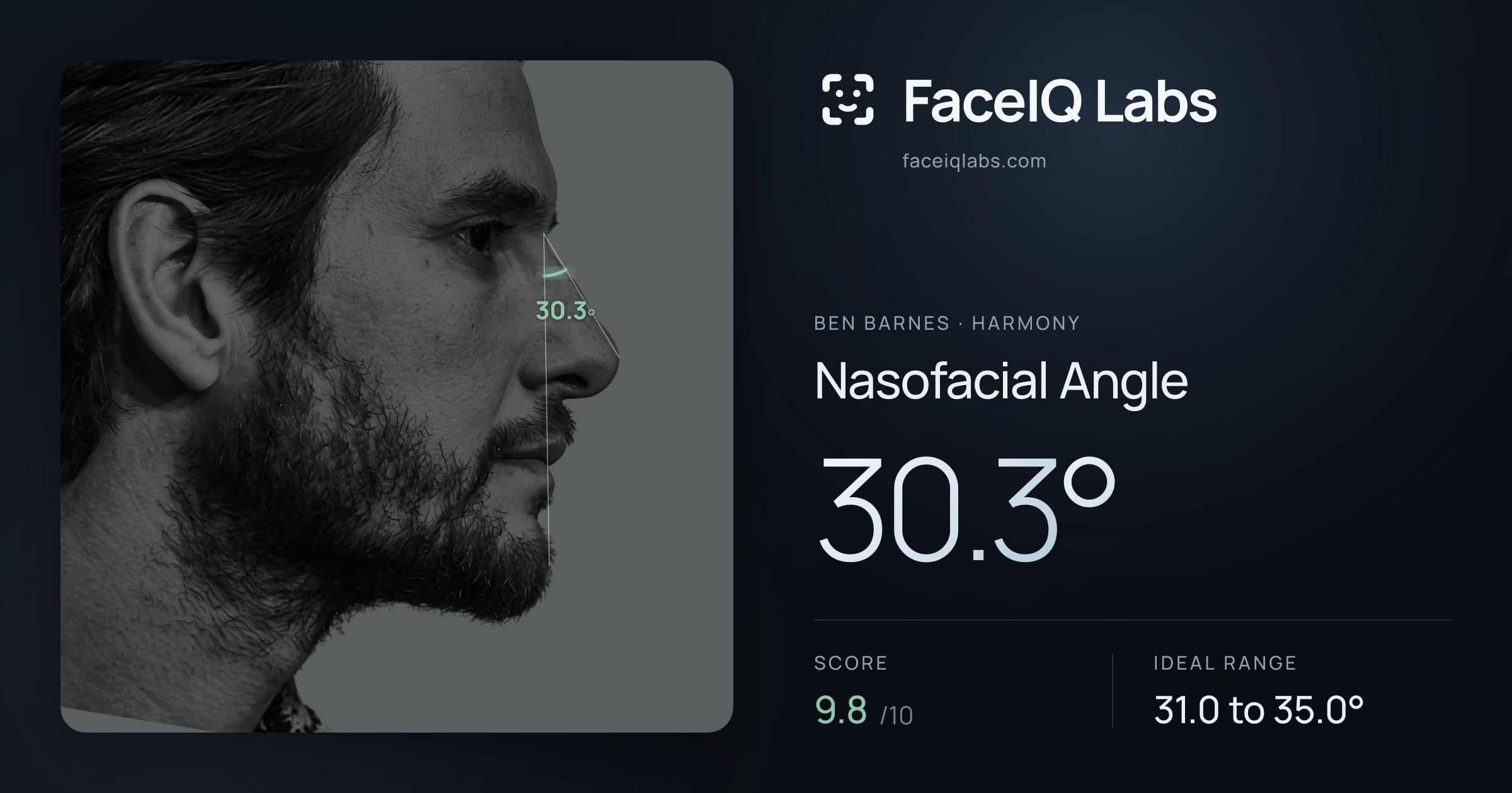 Ben Barnes Nasofacial Angle: 30.3°, drawn on the photo