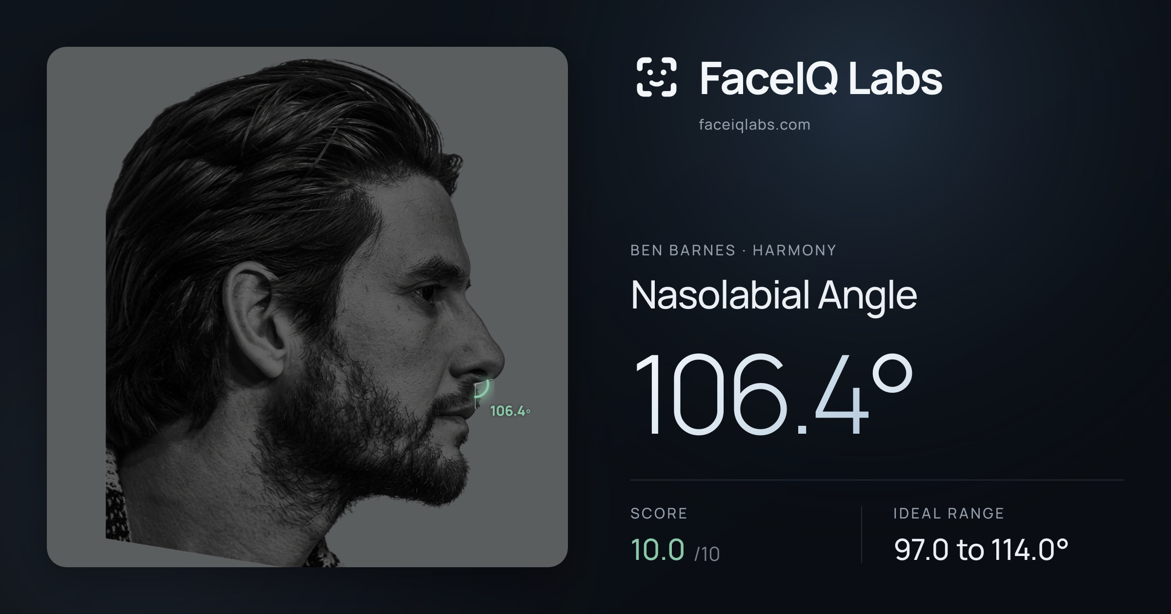 Ben Barnes Nasolabial Angle: 106.4°, drawn on the photo