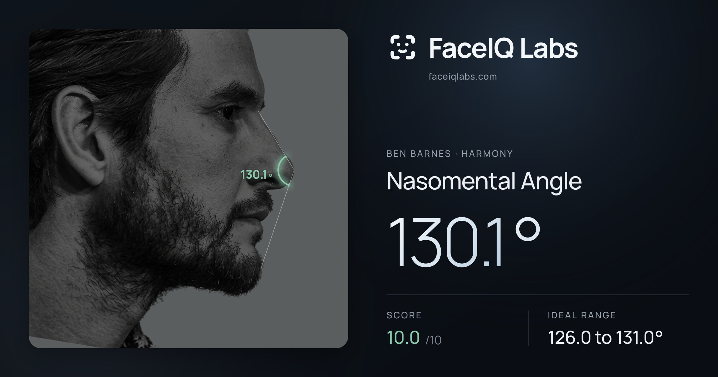 Ben Barnes Nasomental Angle: 130.1°, drawn on the photo