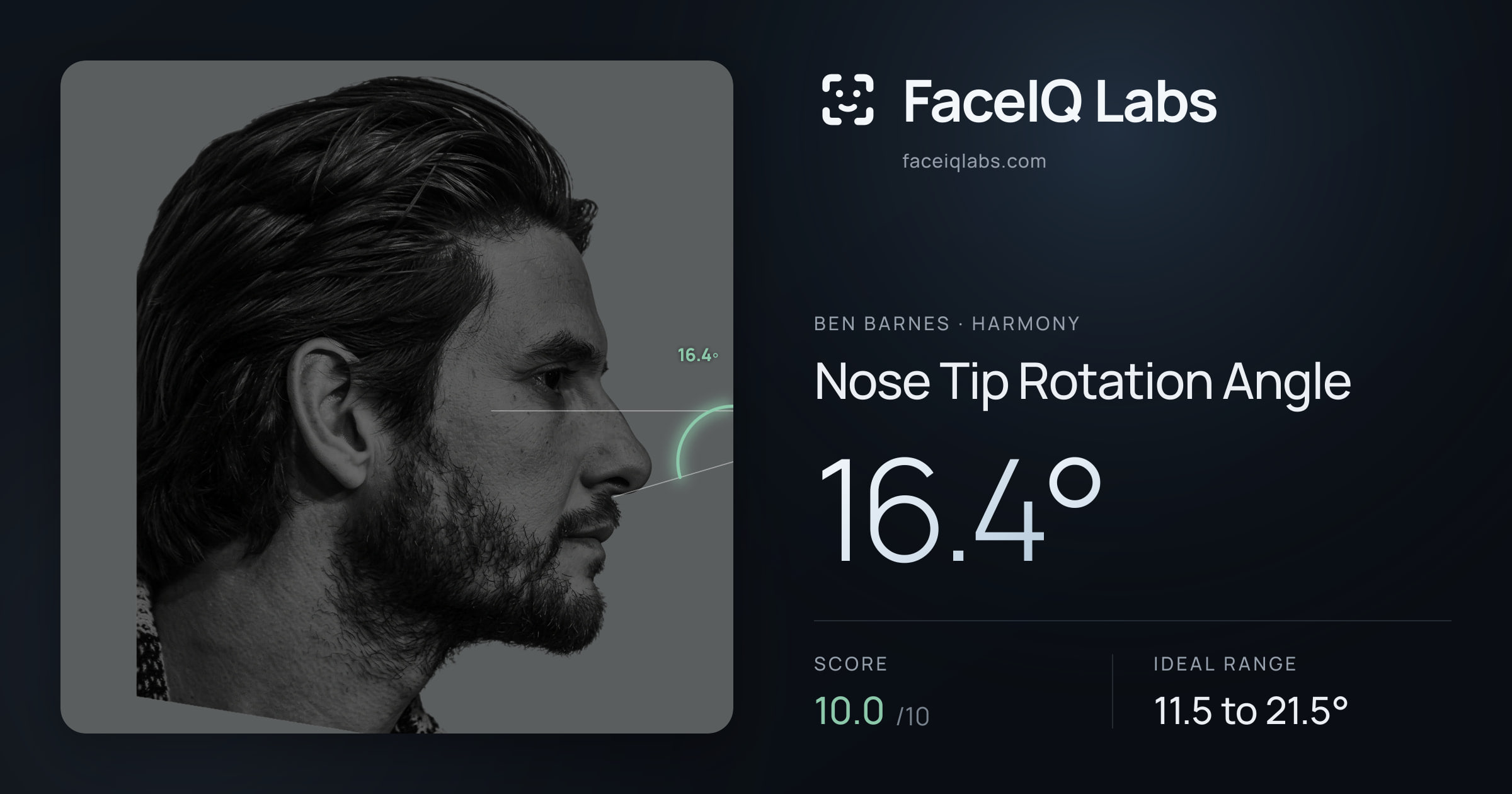 Ben Barnes Nose Tip Rotation Angle: 16.4°, drawn on the photo