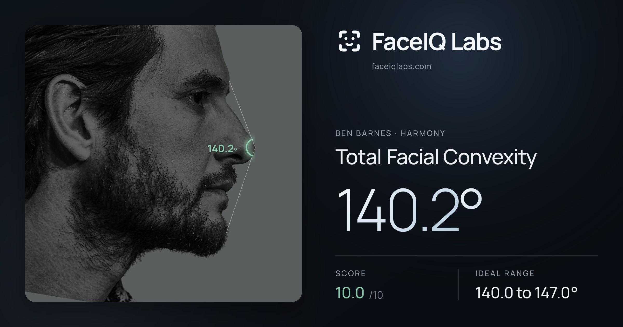 Ben Barnes Total Facial Convexity: 140.2°, drawn on the photo
