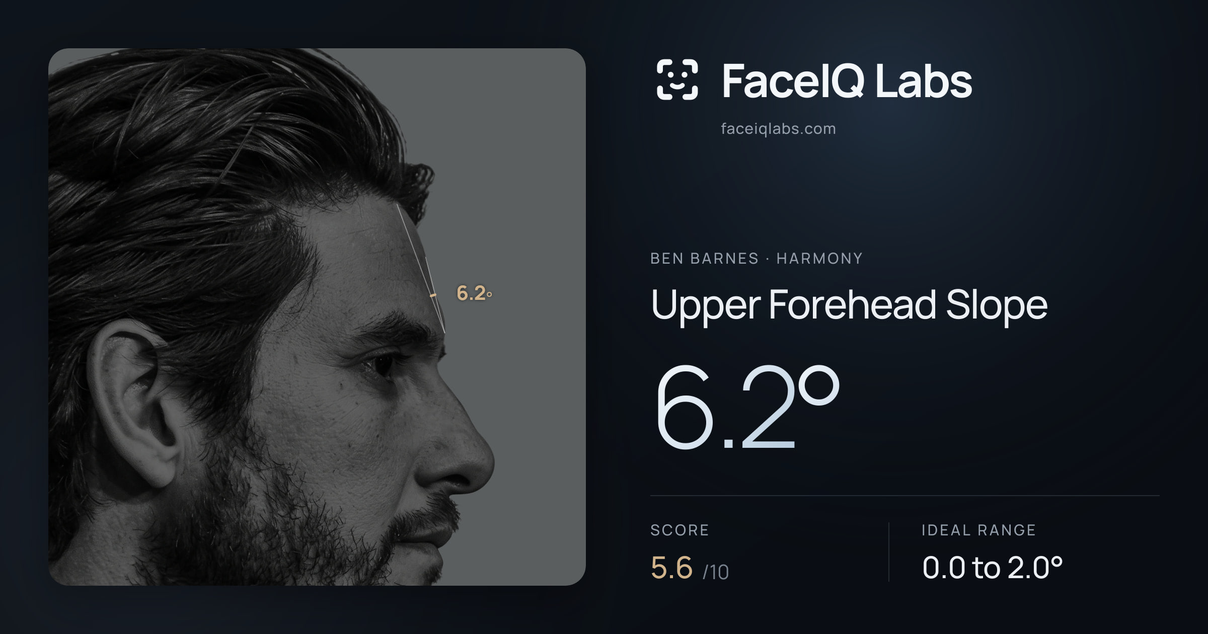 Ben Barnes Upper Forehead Slope: 6.2°, drawn on the photo