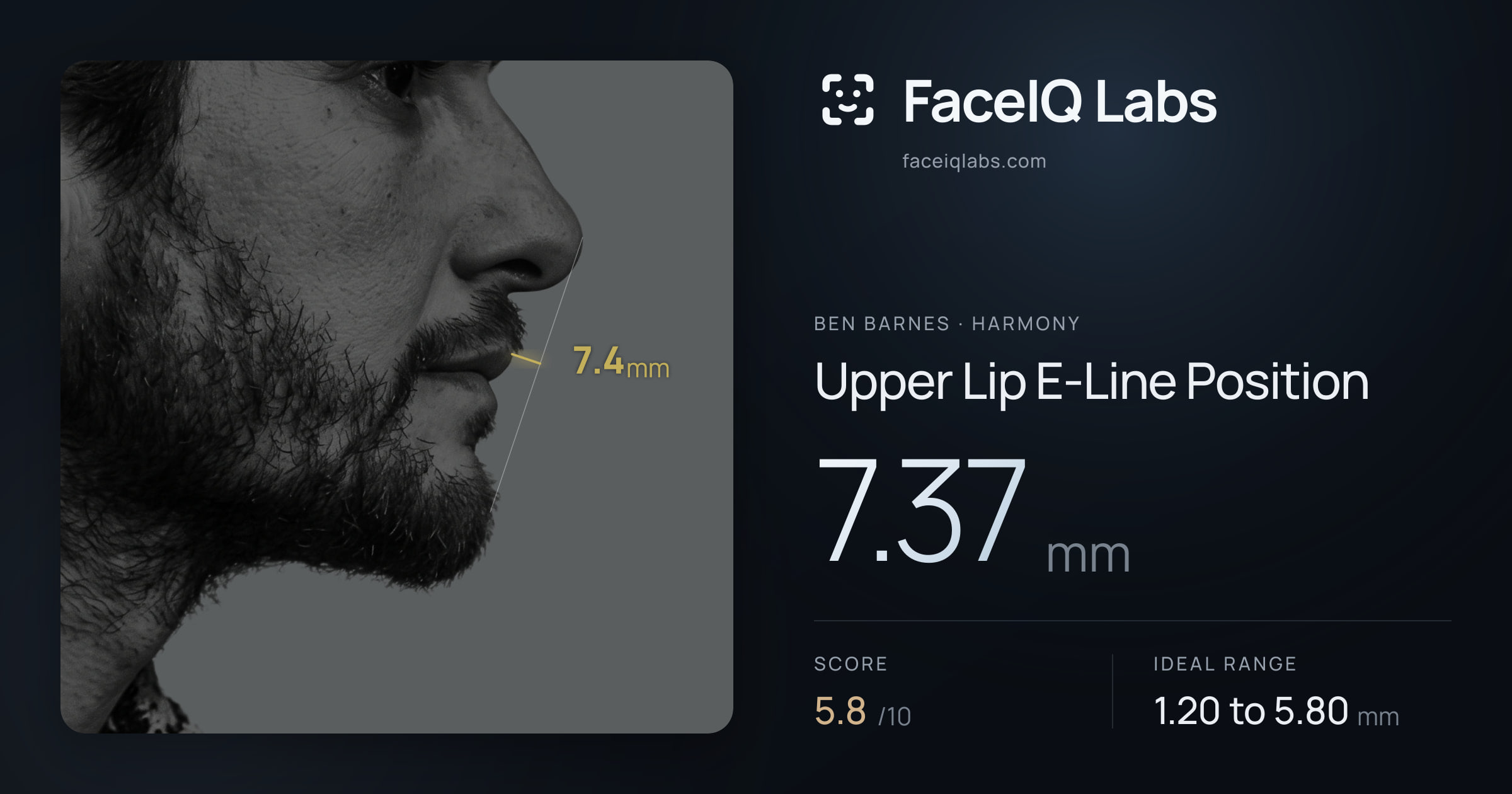 Ben Barnes Upper Lip E-Line Position: 7.37mm, drawn on the photo