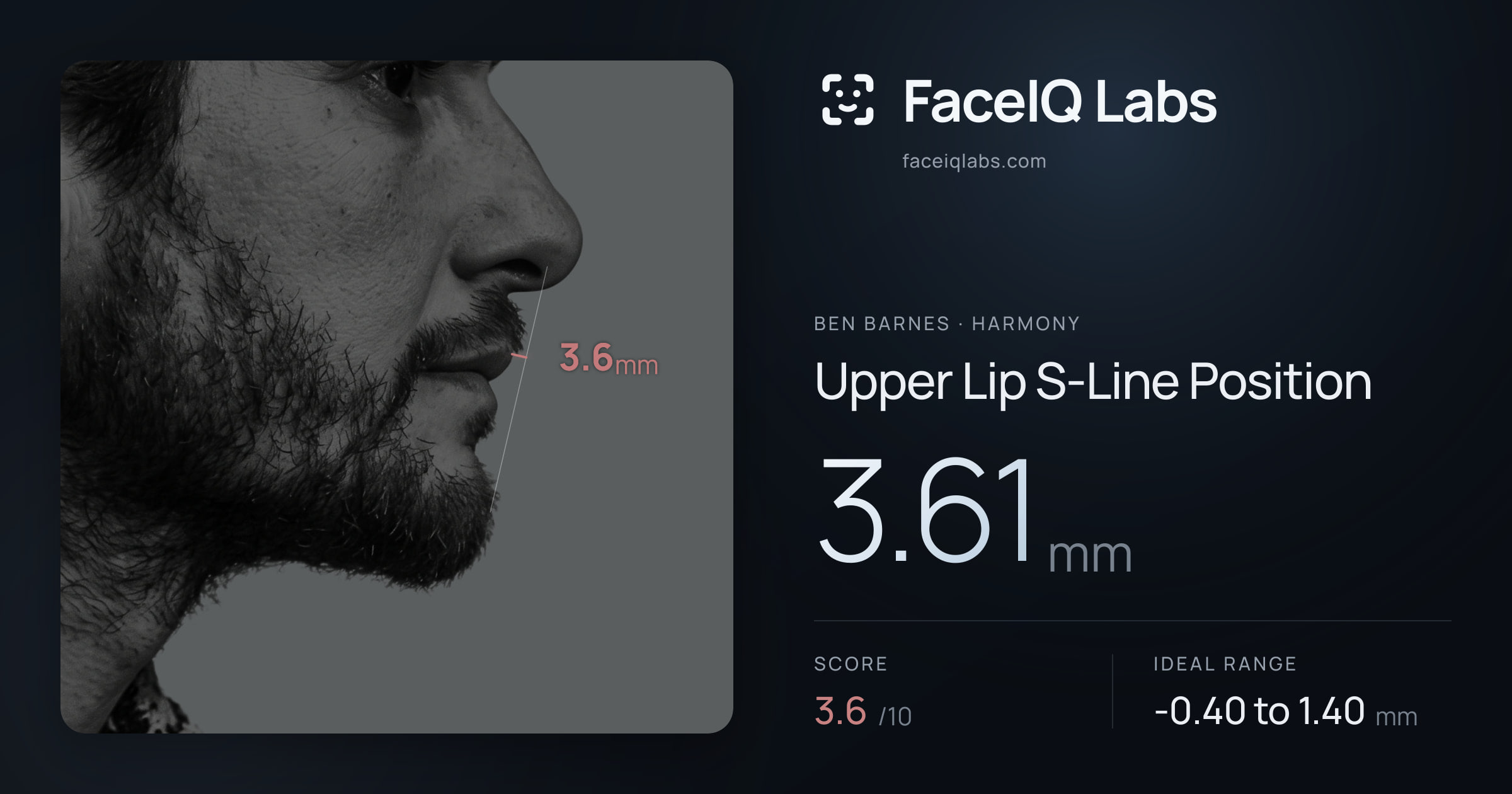 Ben Barnes Upper Lip S-Line Position: 3.61mm, drawn on the photo