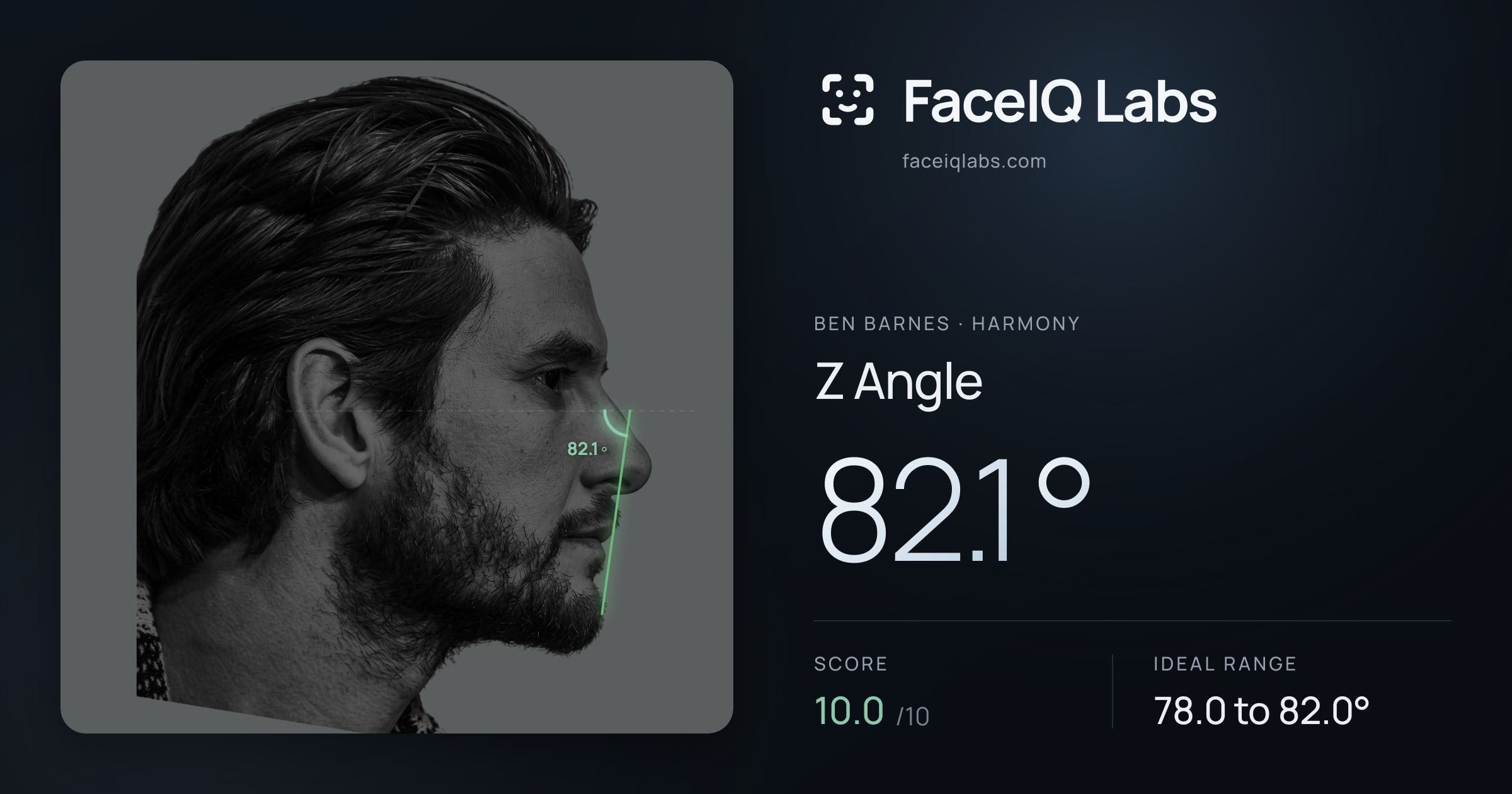 Ben Barnes Z Angle: 82.1°, drawn on the photo
