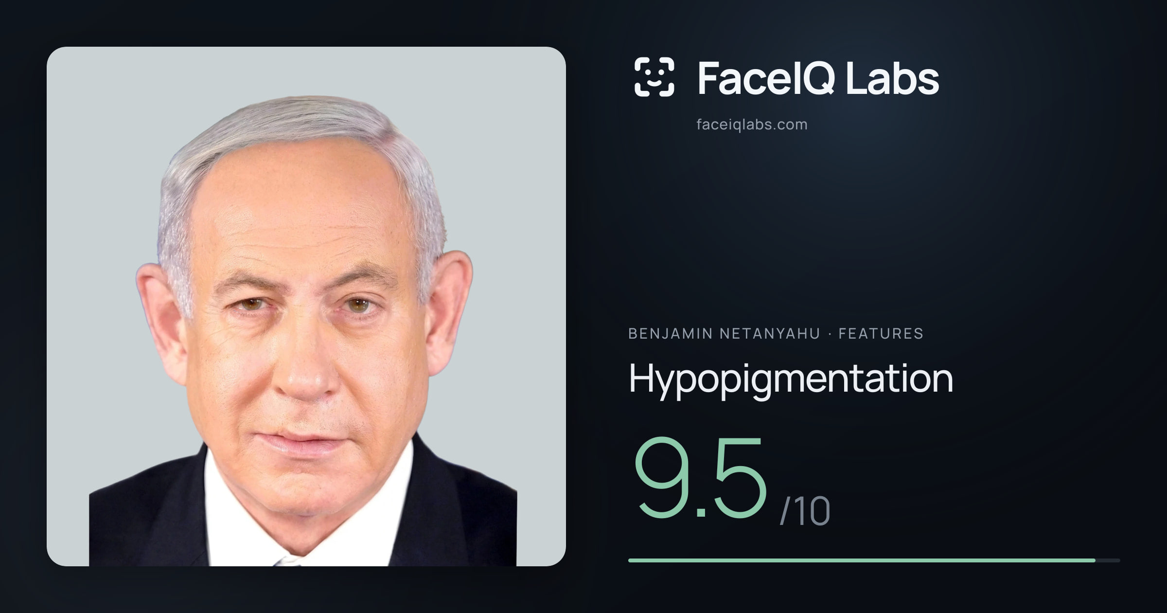 Benjamin Netanyahu Hypopigmentation: 9.5/10, drawn on the photo
