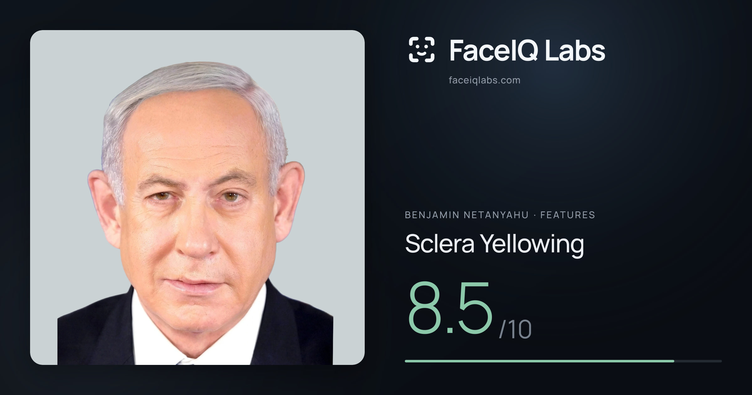 Benjamin Netanyahu Sclera Yellowing: 8.5/10, drawn on the photo