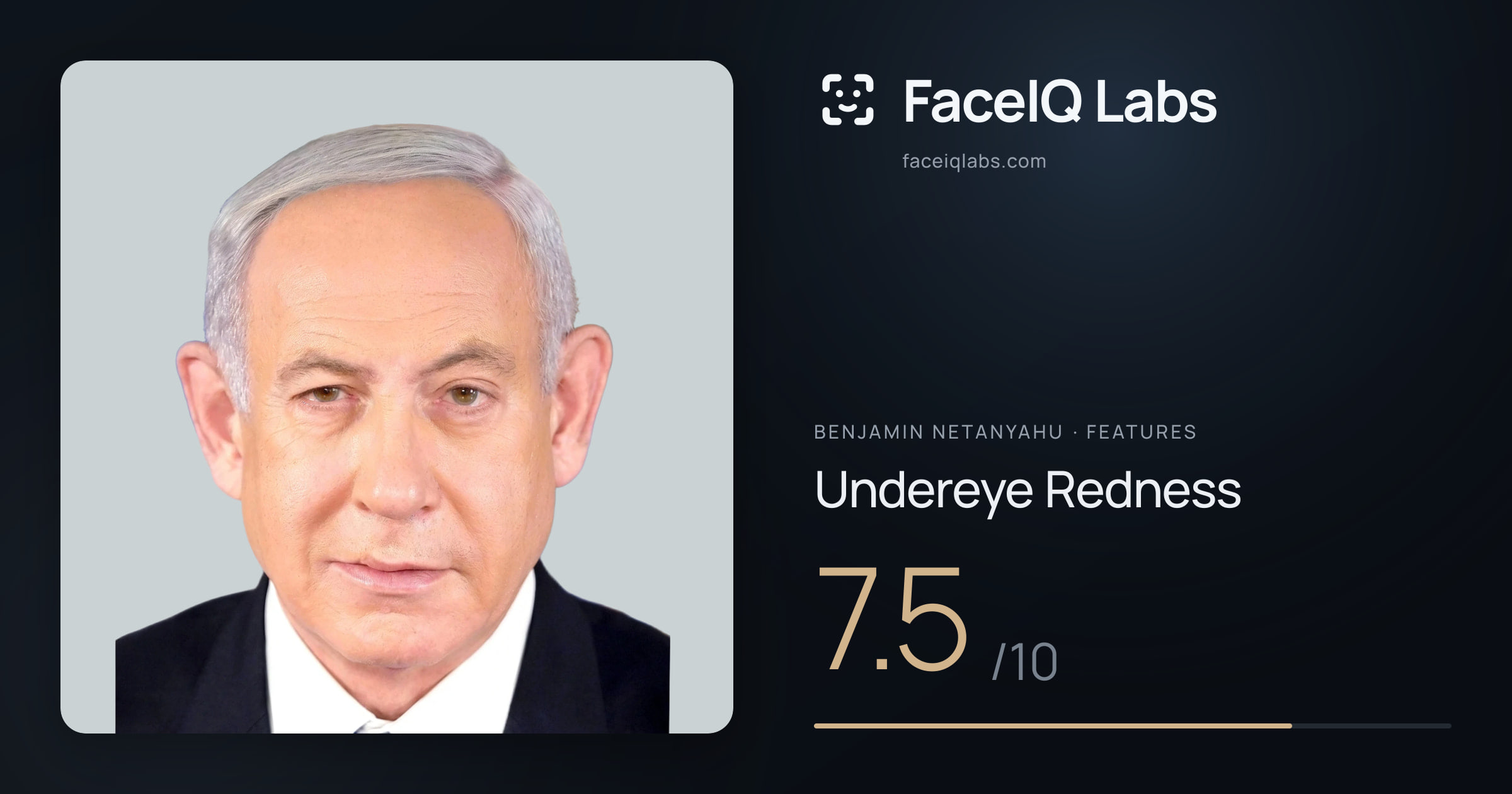 Benjamin Netanyahu Undereye Redness: 7.5/10, drawn on the photo