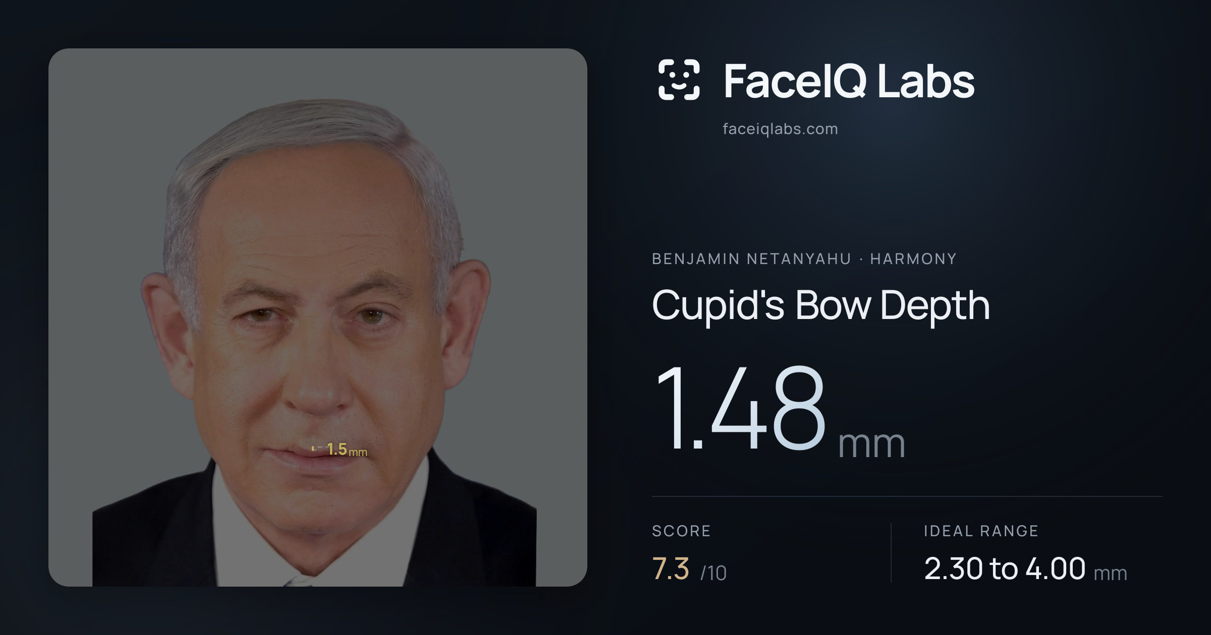 Benjamin Netanyahu Cupid's Bow Depth: 1.48mm, drawn on the photo