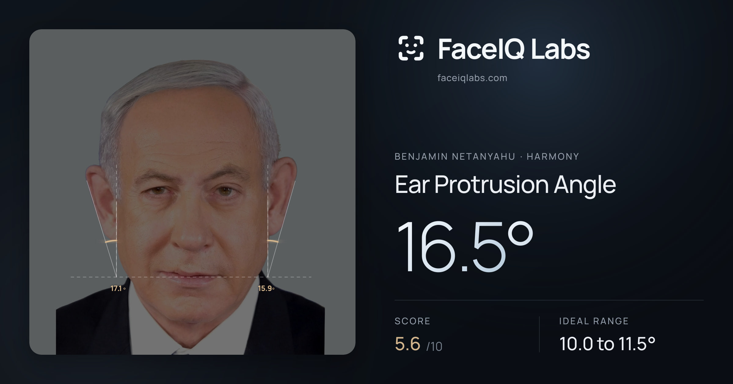 Benjamin Netanyahu Ear Protrusion Angle: 16.5°, drawn on the photo