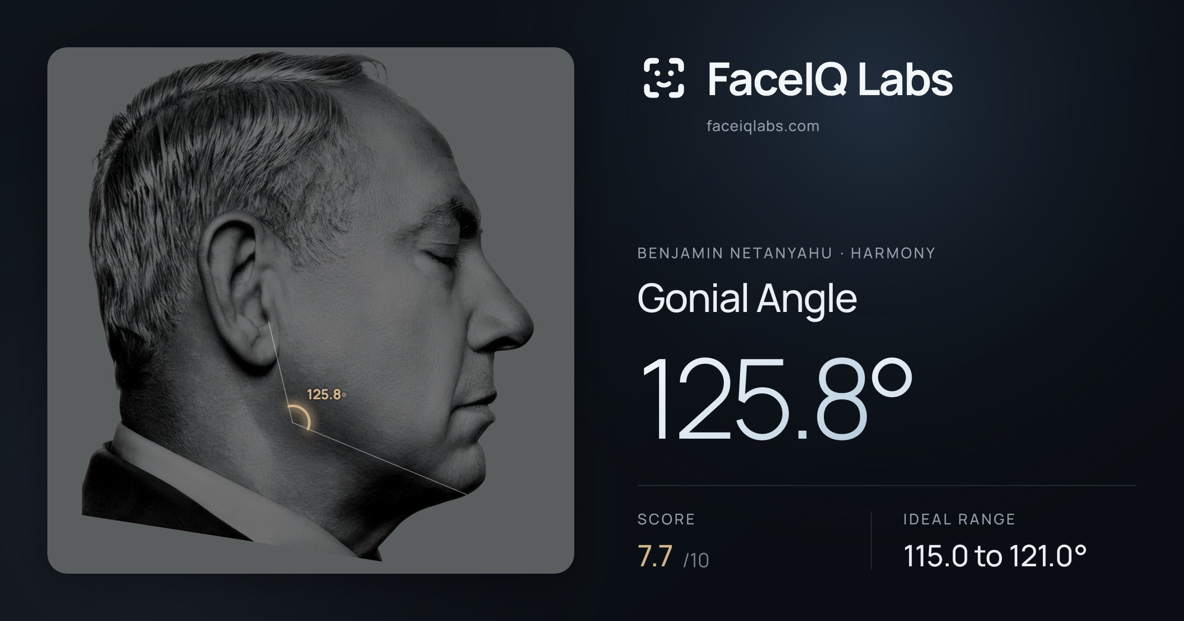 Benjamin Netanyahu Gonial Angle: 125.8°, drawn on the photo