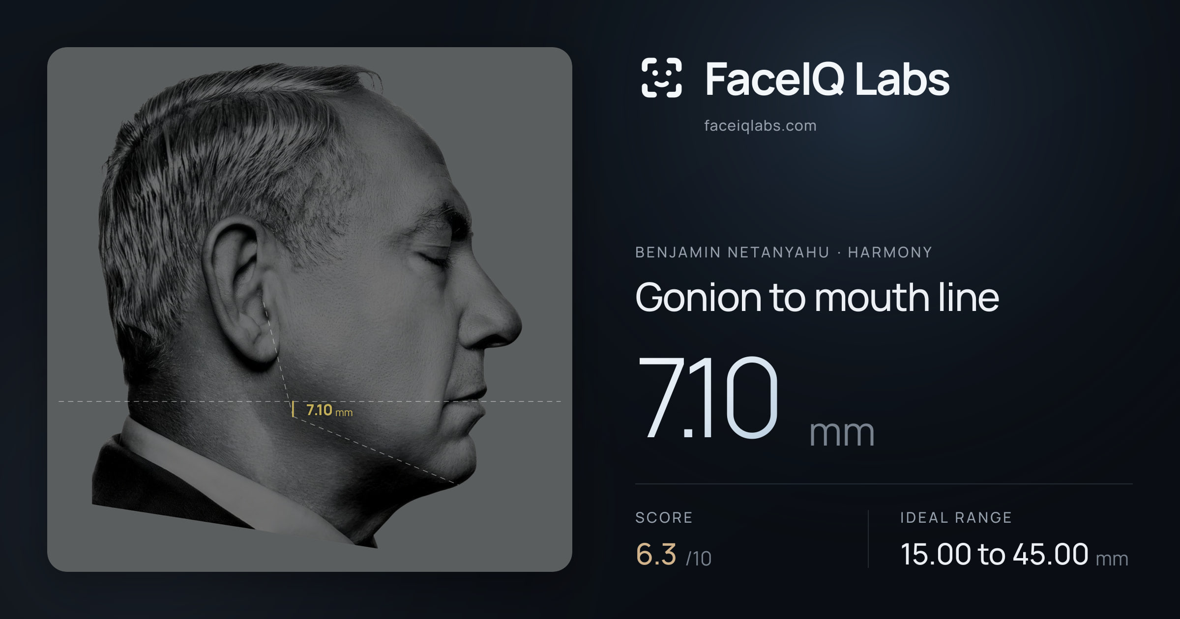 Benjamin Netanyahu Gonion to mouth line: 7.10mm, drawn on the photo