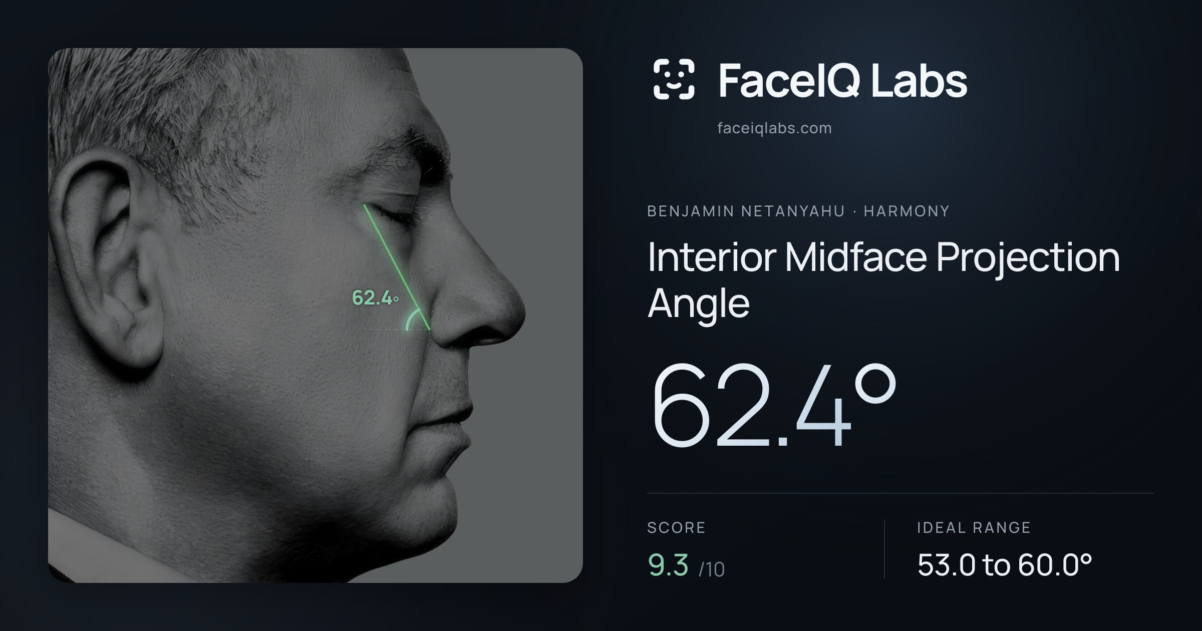 Benjamin Netanyahu Interior Midface Projection Angle: 62.4°, drawn on the photo