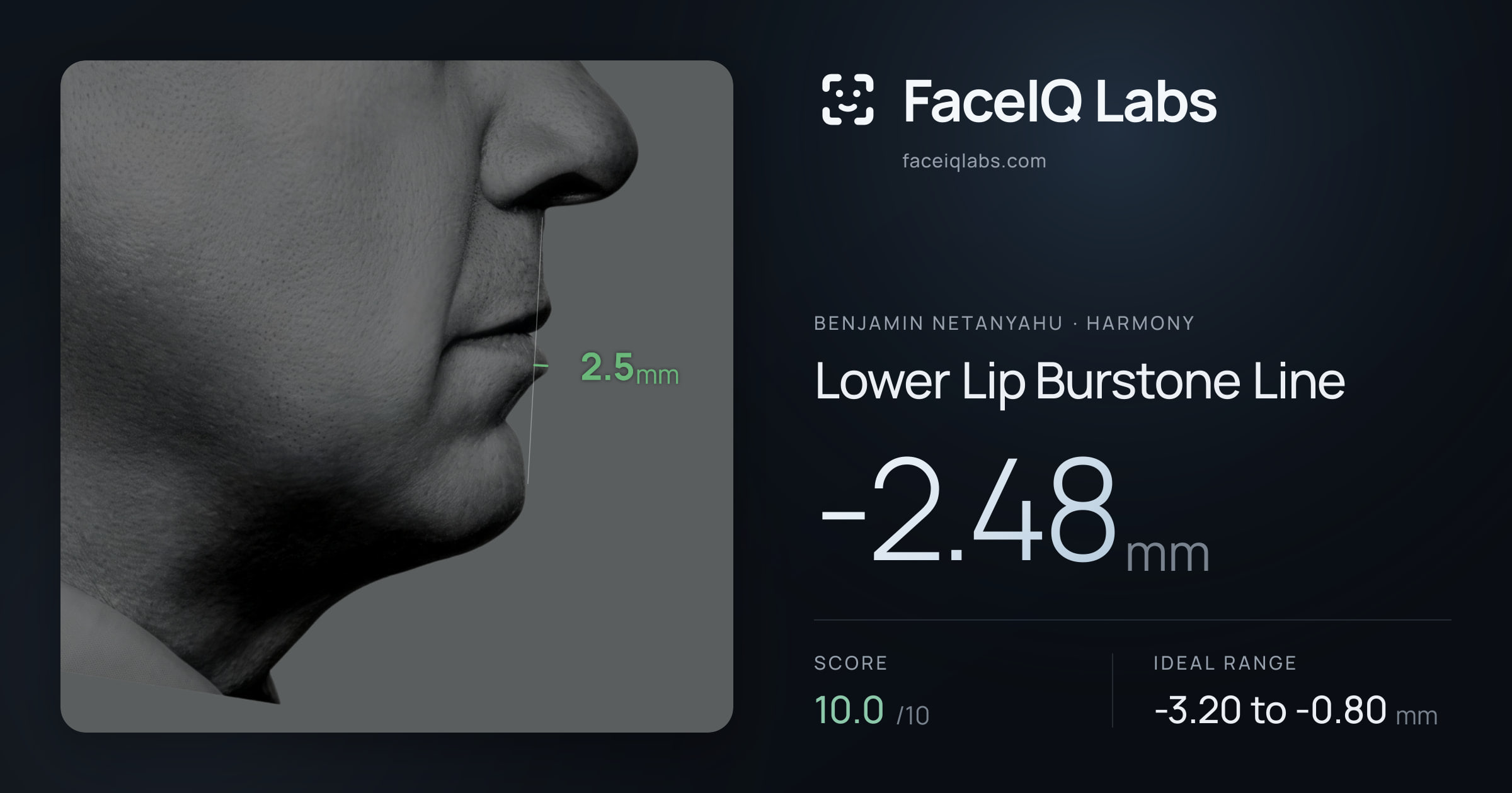 Benjamin Netanyahu Lower Lip Burstone Line: -2.48mm, drawn on the photo