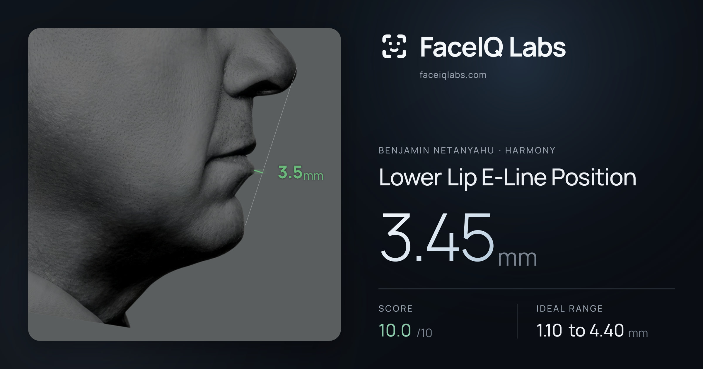 Benjamin Netanyahu Lower Lip E-Line Position: 3.45mm, drawn on the photo