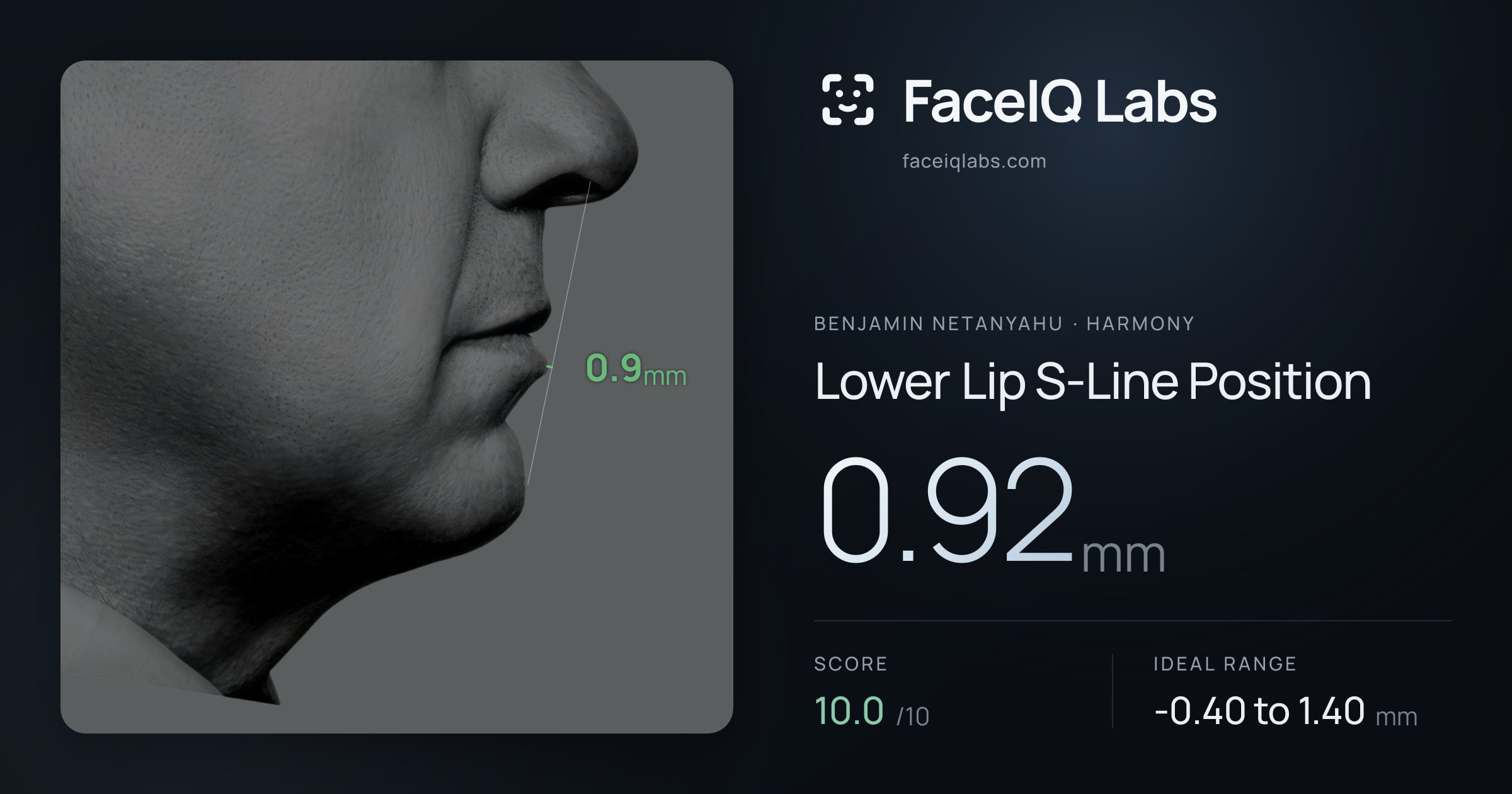 Benjamin Netanyahu Lower Lip S-Line Position: 0.92mm, drawn on the photo