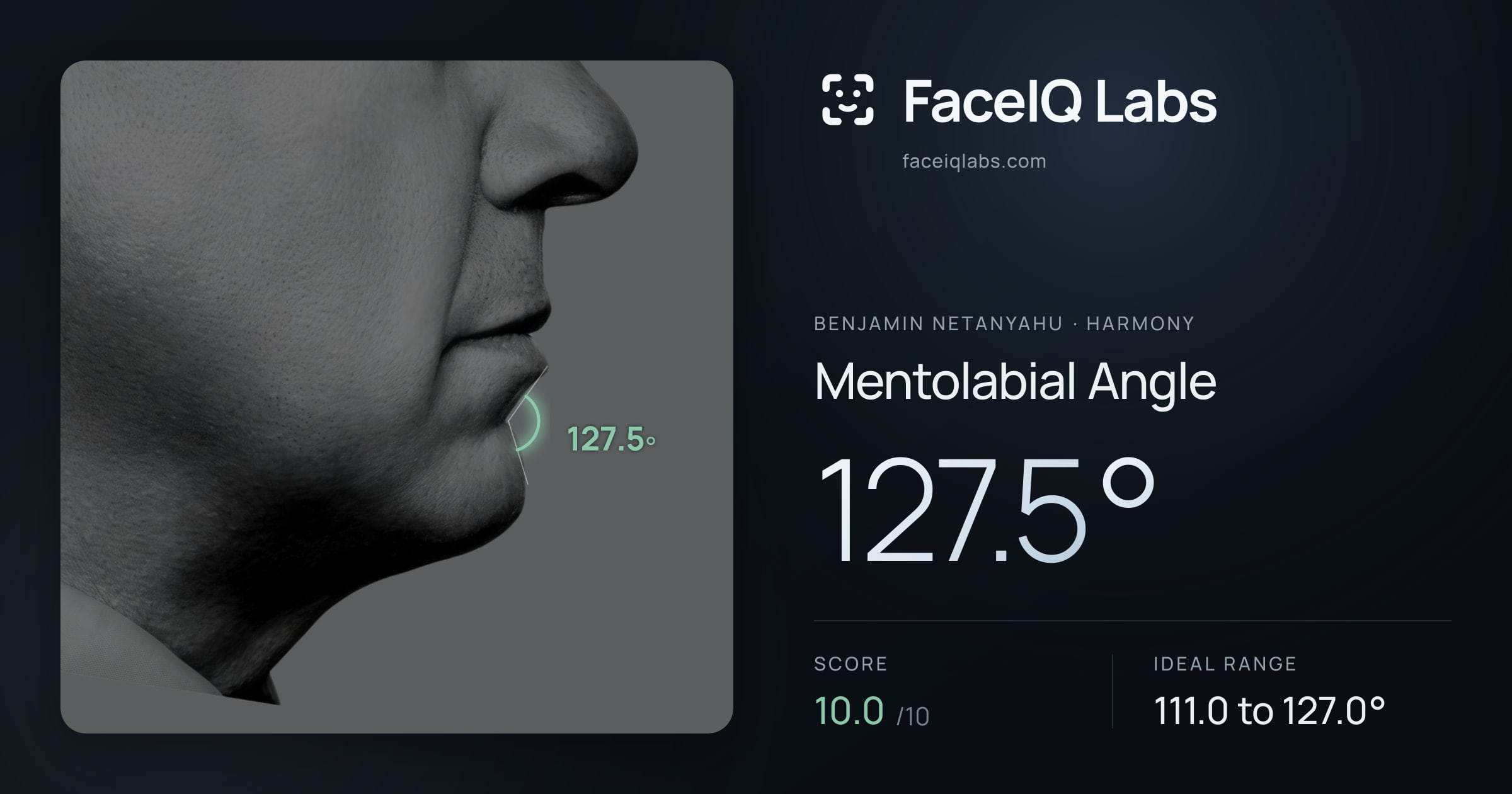 Benjamin Netanyahu Mentolabial Angle: 127.5°, drawn on the photo