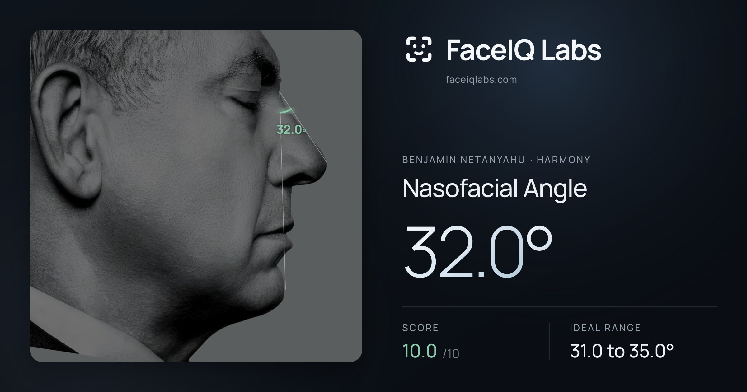 Benjamin Netanyahu Nasofacial Angle: 32.0°, drawn on the photo