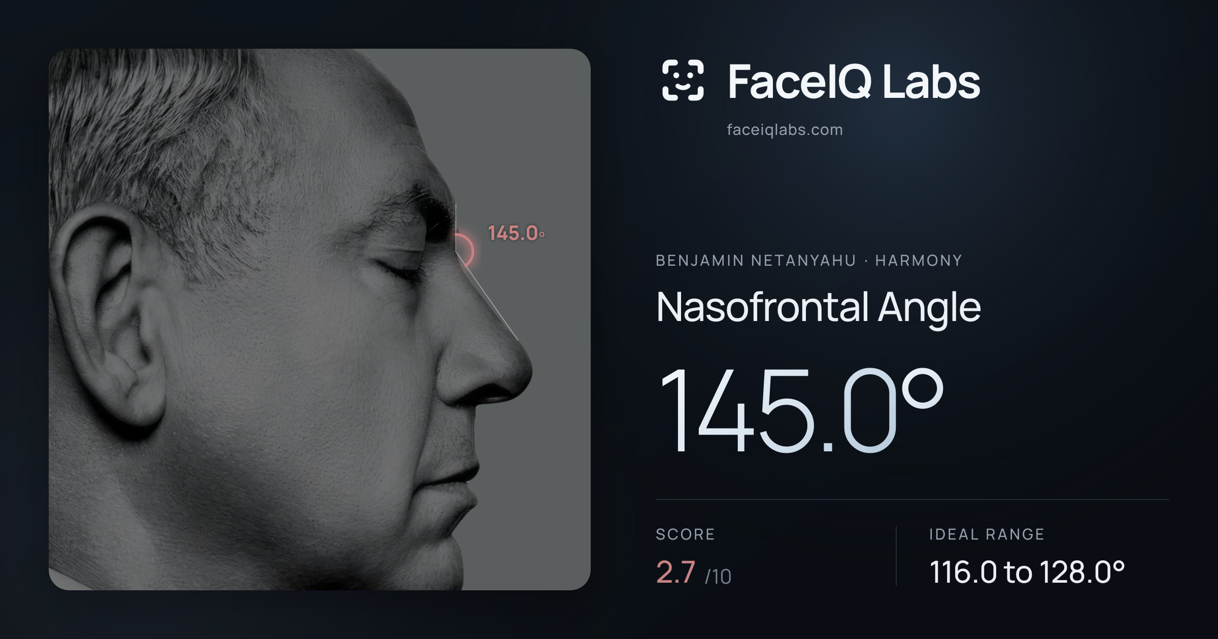 Benjamin Netanyahu Nasofrontal Angle: 145.0°, drawn on the photo