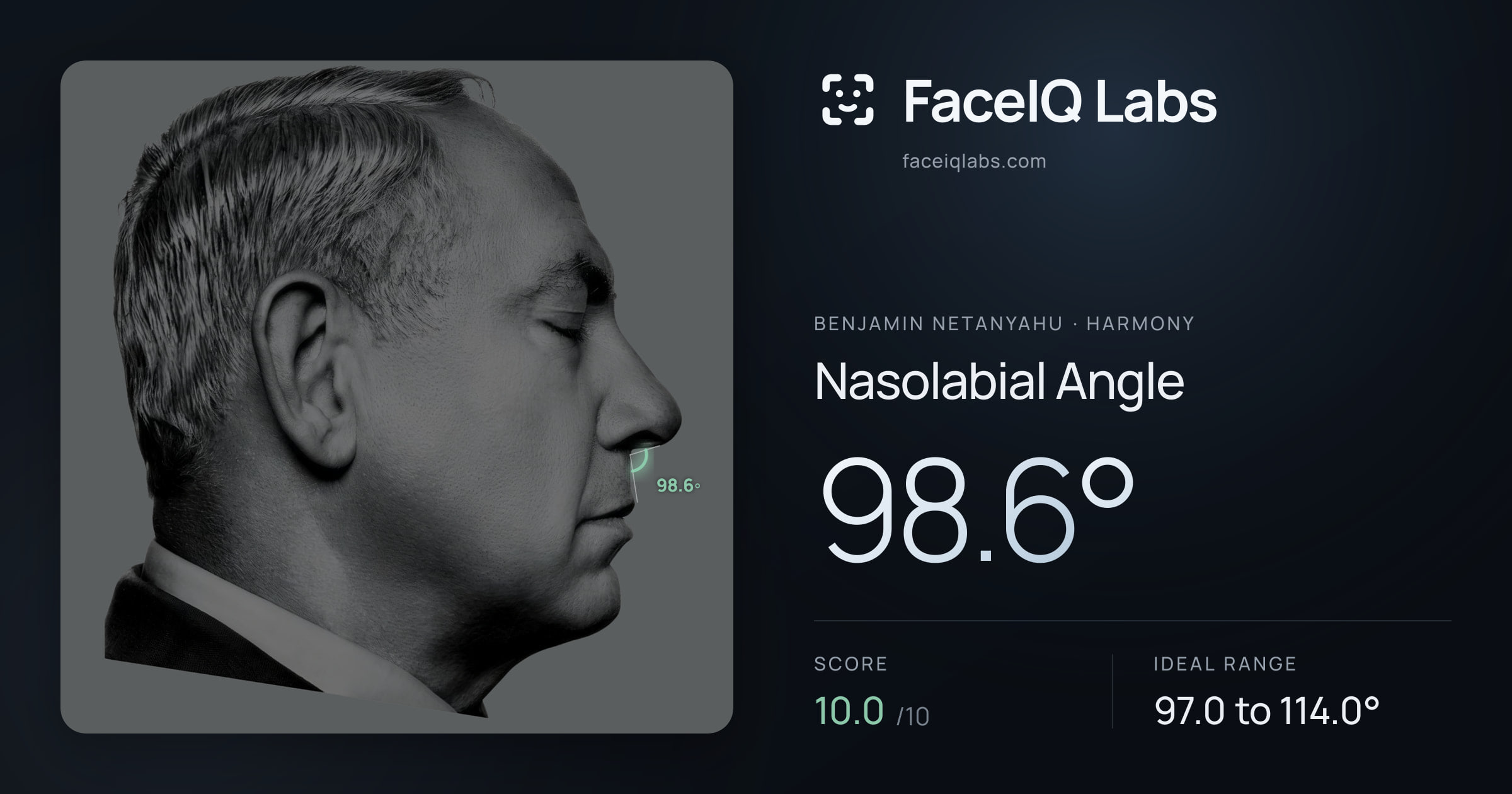 Benjamin Netanyahu Nasolabial Angle: 98.6°, drawn on the photo