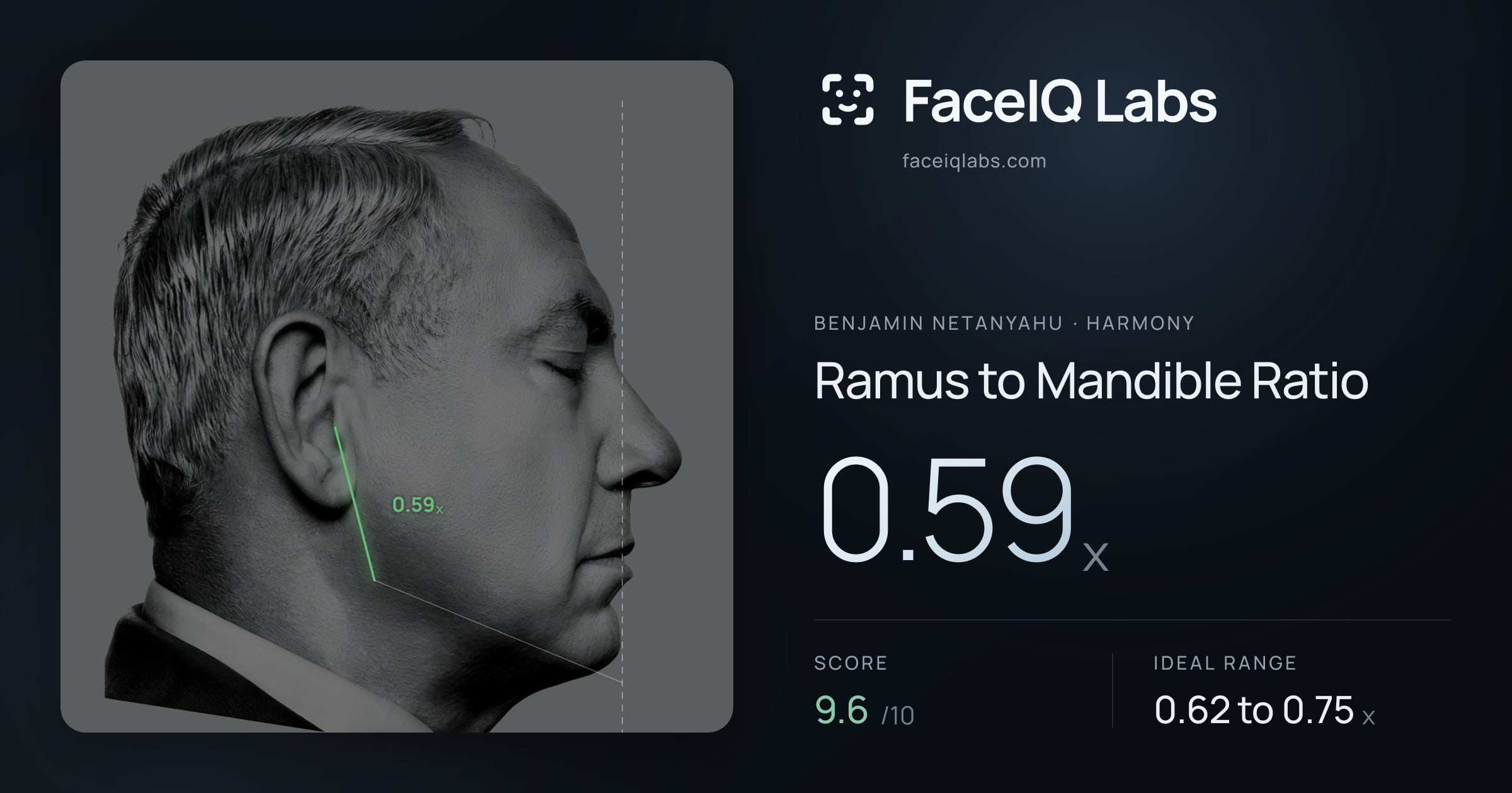 Benjamin Netanyahu Ramus to Mandible Ratio: 0.59x, drawn on the photo