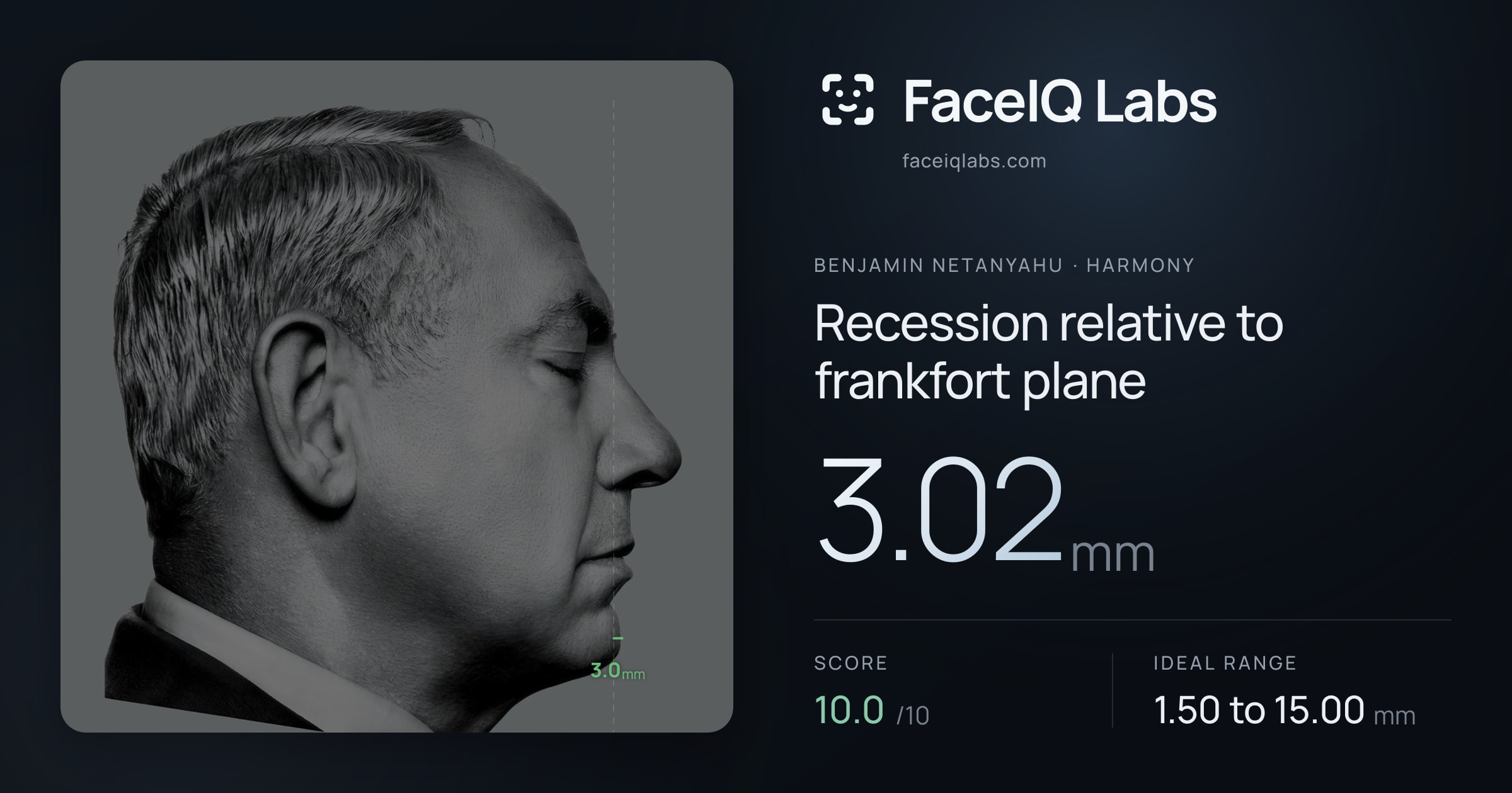 Benjamin Netanyahu Recession relative to frankfort plane: 3.02mm, drawn on the photo
