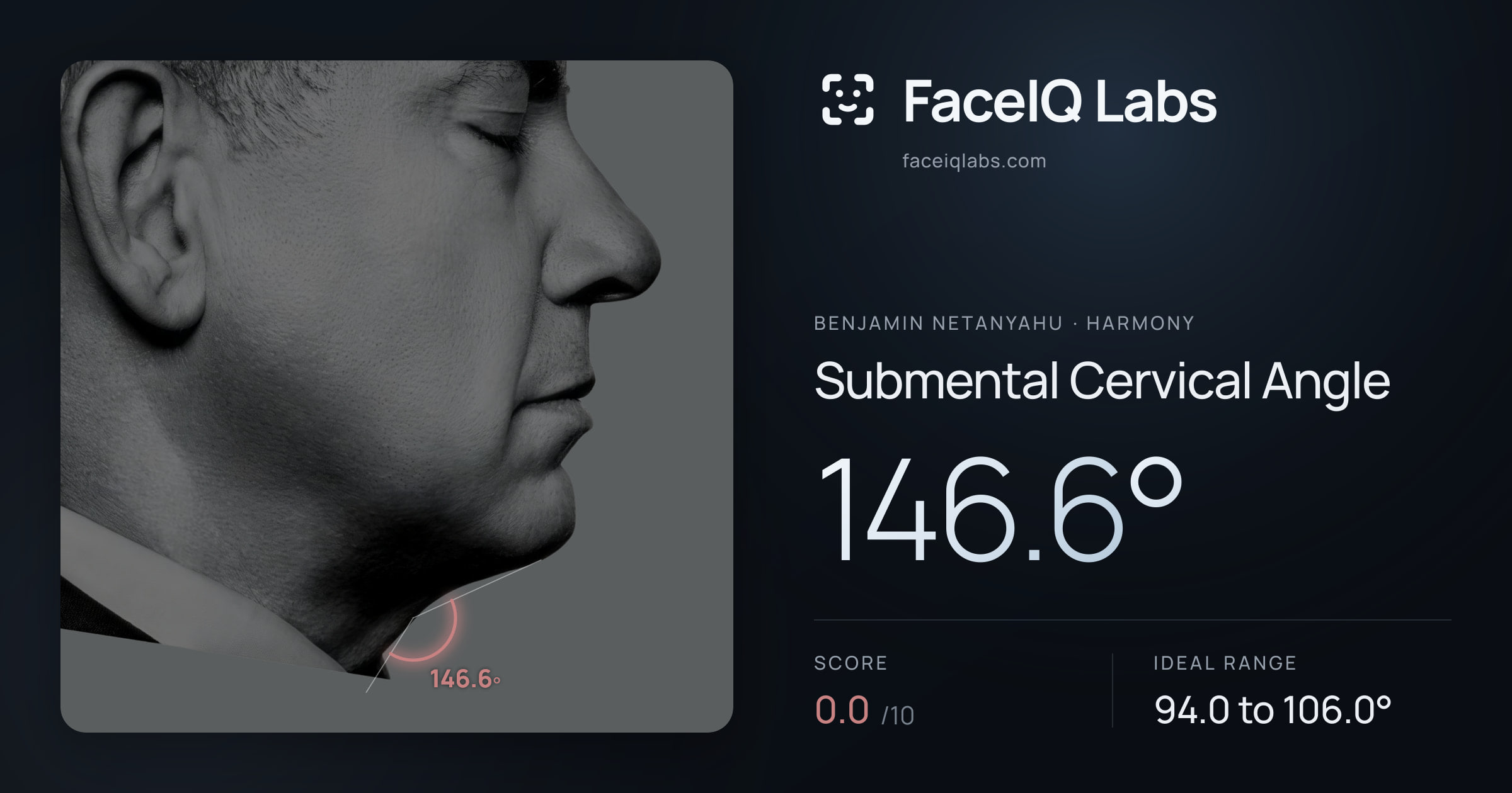Benjamin Netanyahu Submental Cervical Angle: 146.6°, drawn on the photo