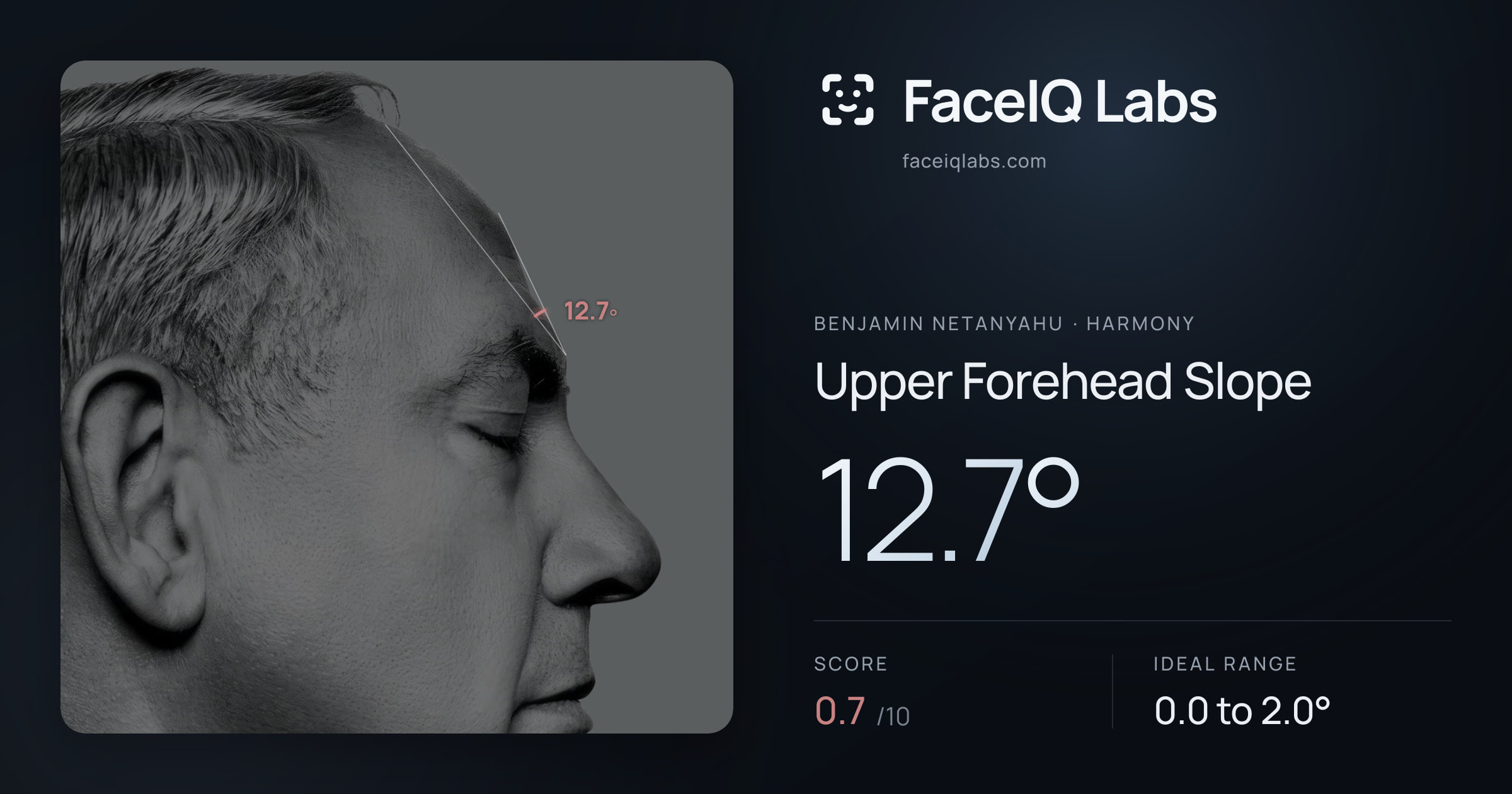 Benjamin Netanyahu Upper Forehead Slope: 12.7°, drawn on the photo