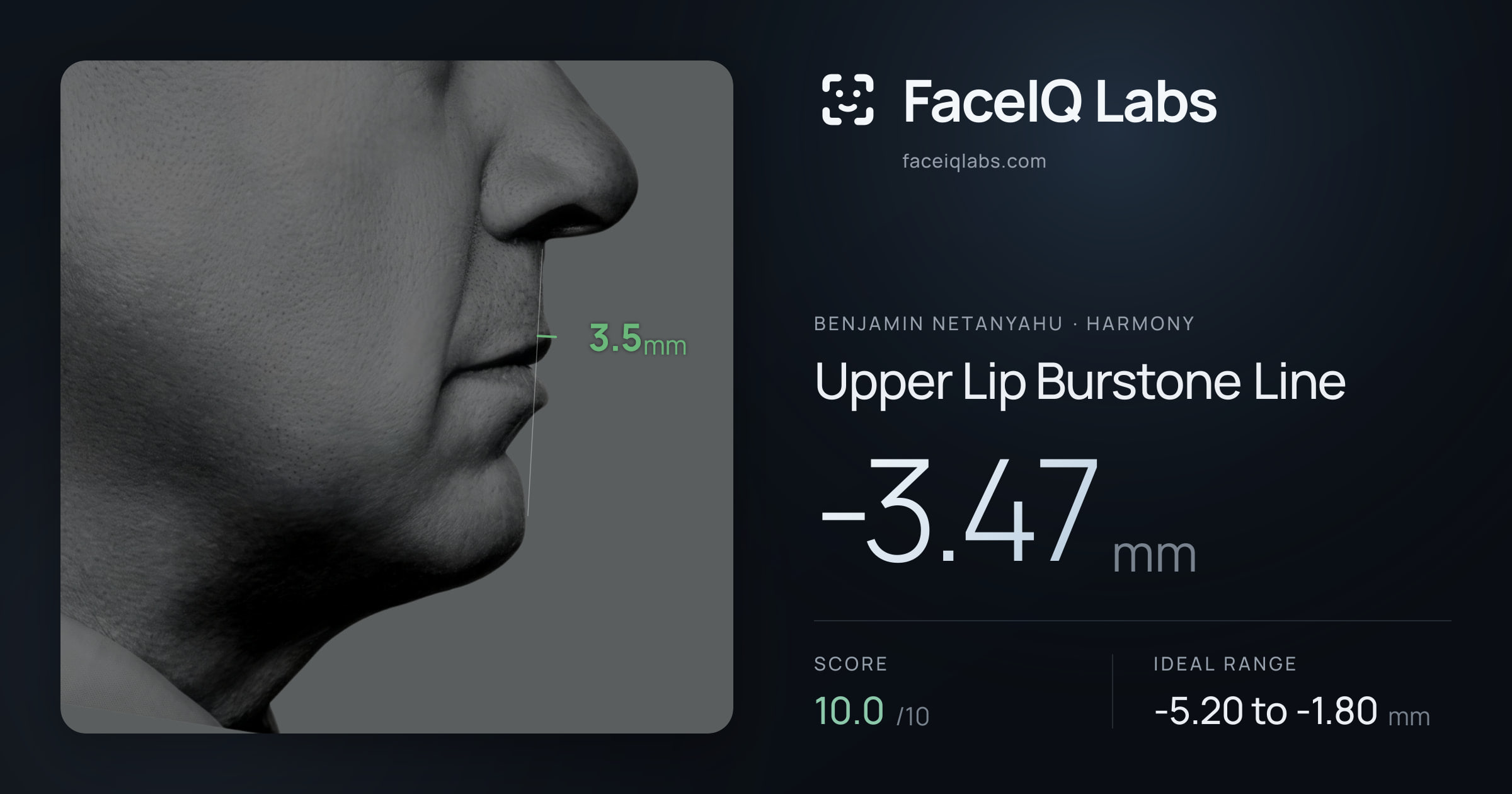 Benjamin Netanyahu Upper Lip Burstone Line: -3.47mm, drawn on the photo