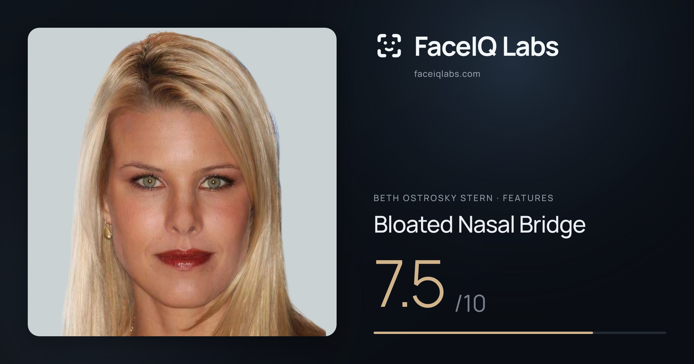 Beth Ostrosky Stern Bloated Nasal Bridge: 7.5/10, drawn on the photo
