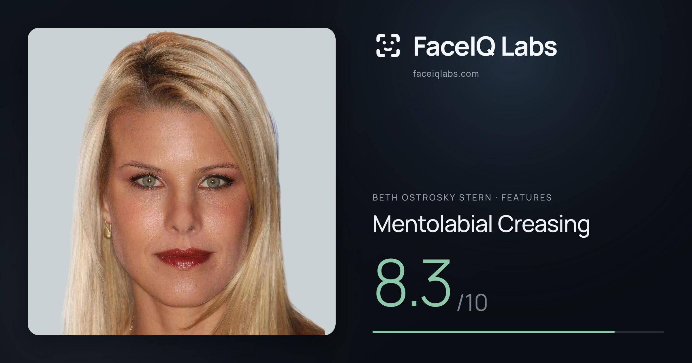 Beth Ostrosky Stern Mentolabial Creasing: 8.3/10, drawn on the photo