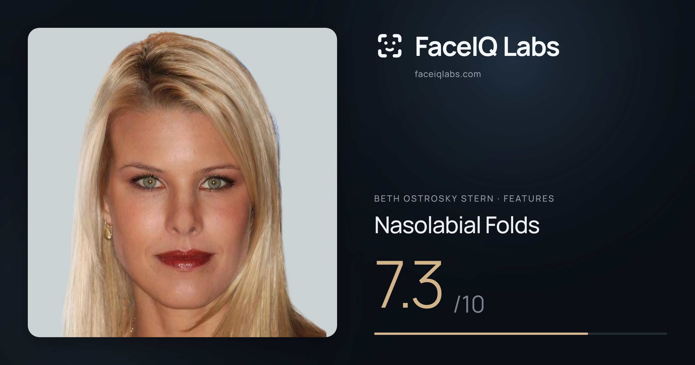 Beth Ostrosky Stern Nasolabial Folds: 7.3/10, drawn on the photo