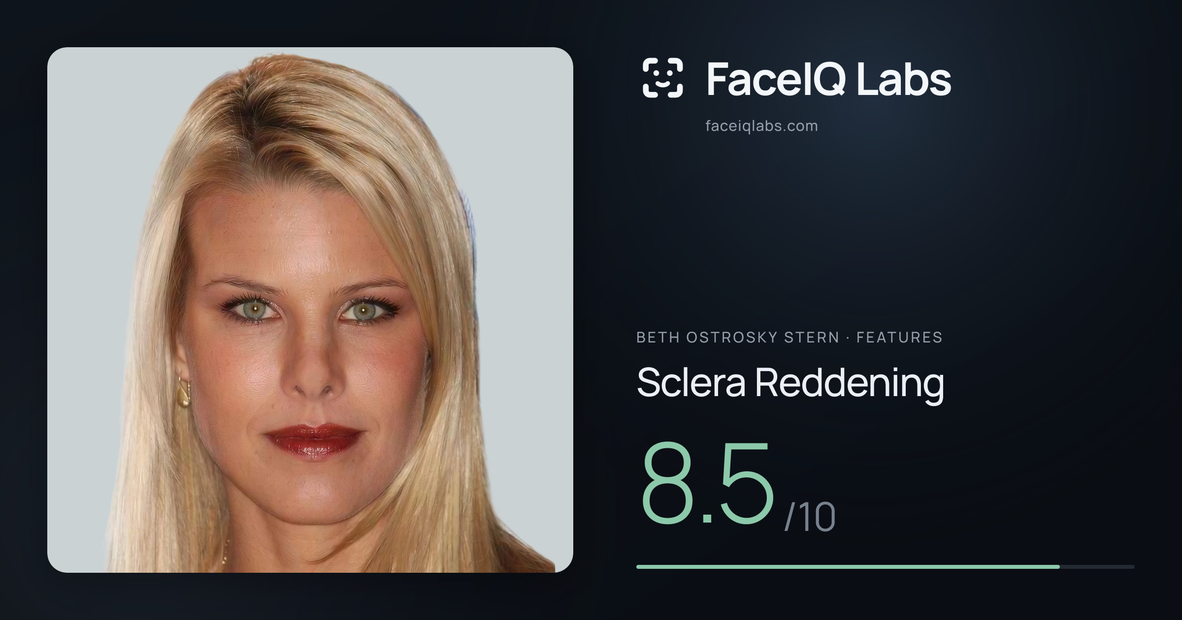 Beth Ostrosky Stern Sclera Reddening: 8.5/10, drawn on the photo
