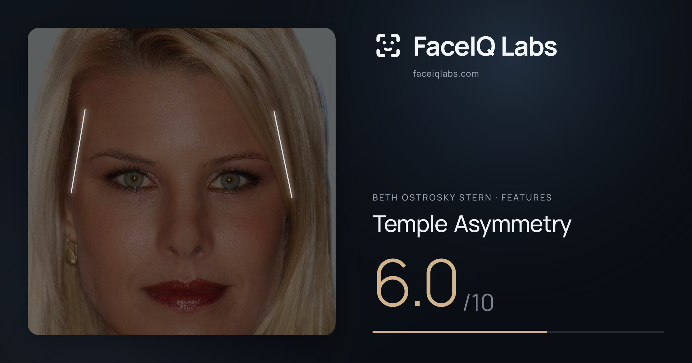Beth Ostrosky Stern Temple Asymmetry: 6.0/10, drawn on the photo