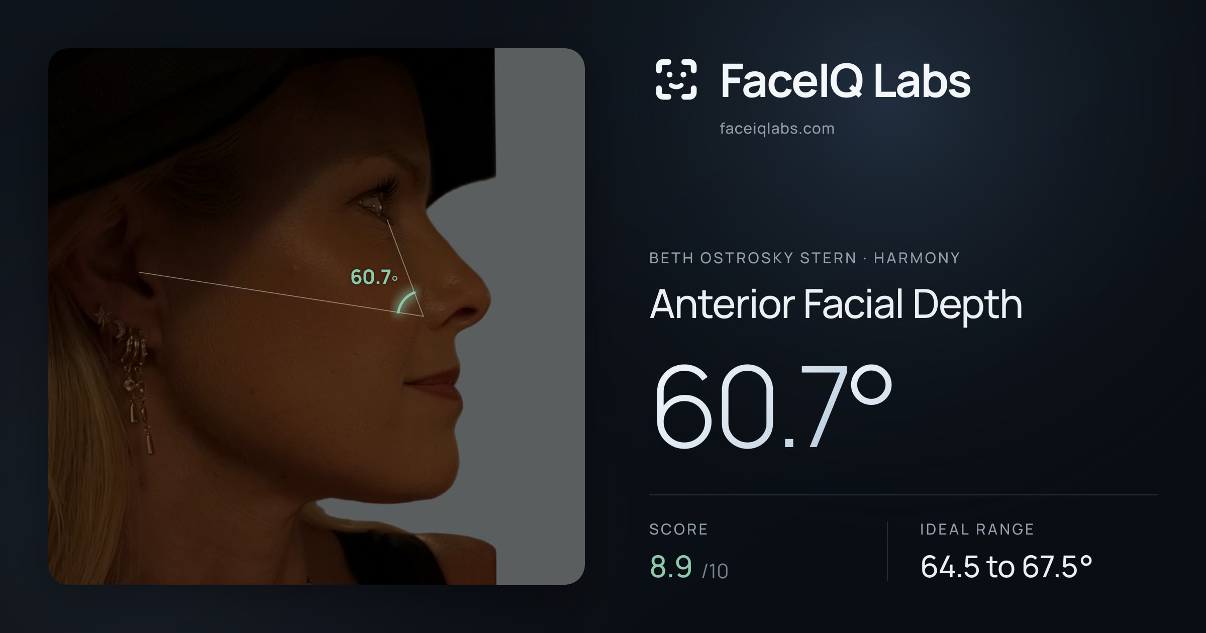 Beth Ostrosky Stern Anterior Facial Depth: 60.7°, drawn on the photo