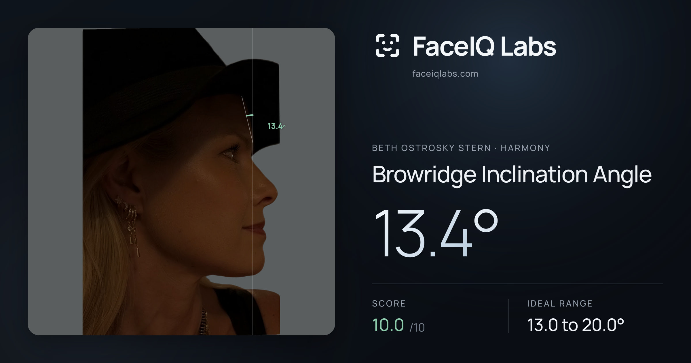 Beth Ostrosky Stern Browridge Inclination Angle: 13.4°, drawn on the photo