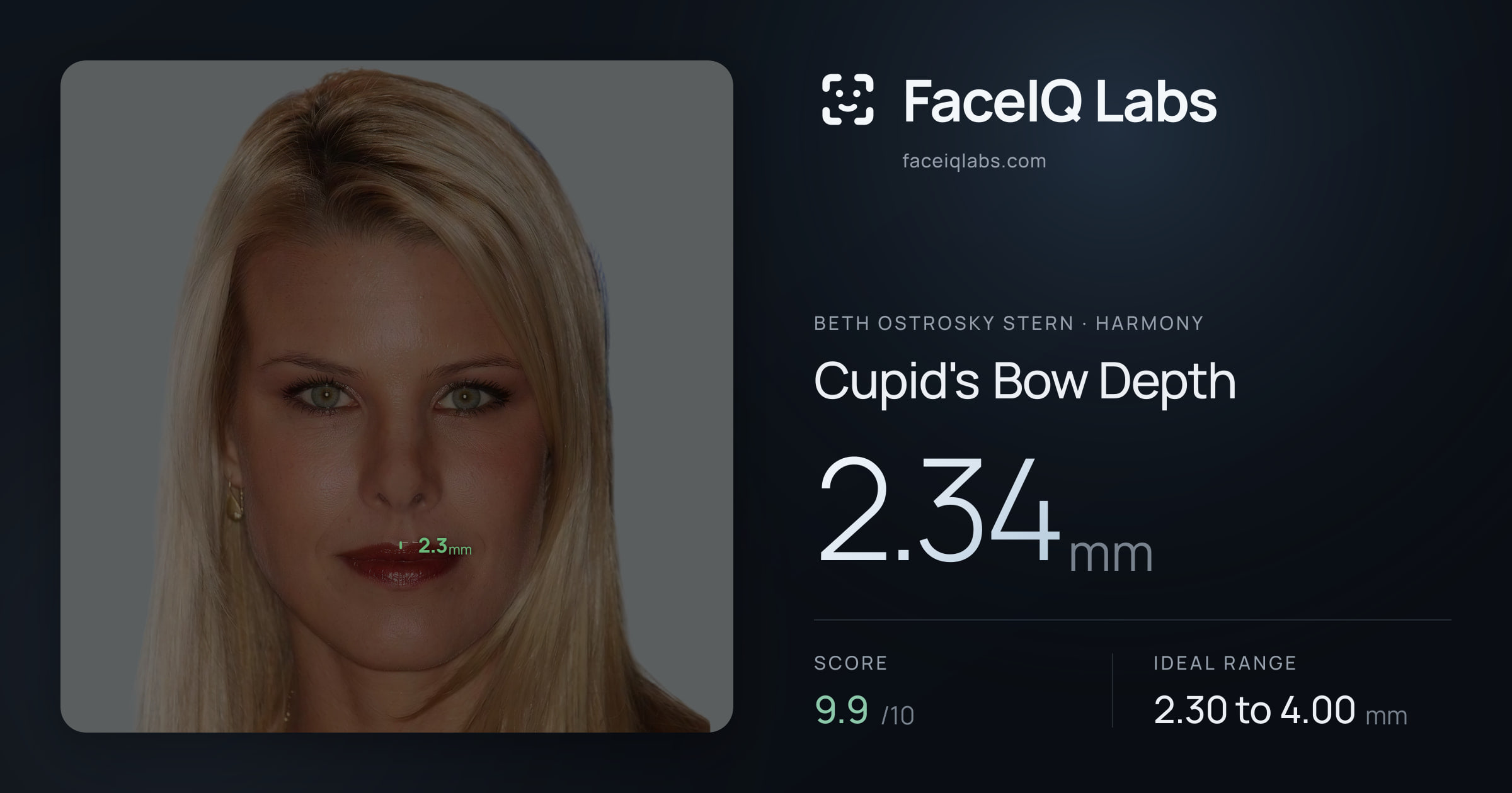 Beth Ostrosky Stern Cupid's Bow Depth: 2.34mm, drawn on the photo