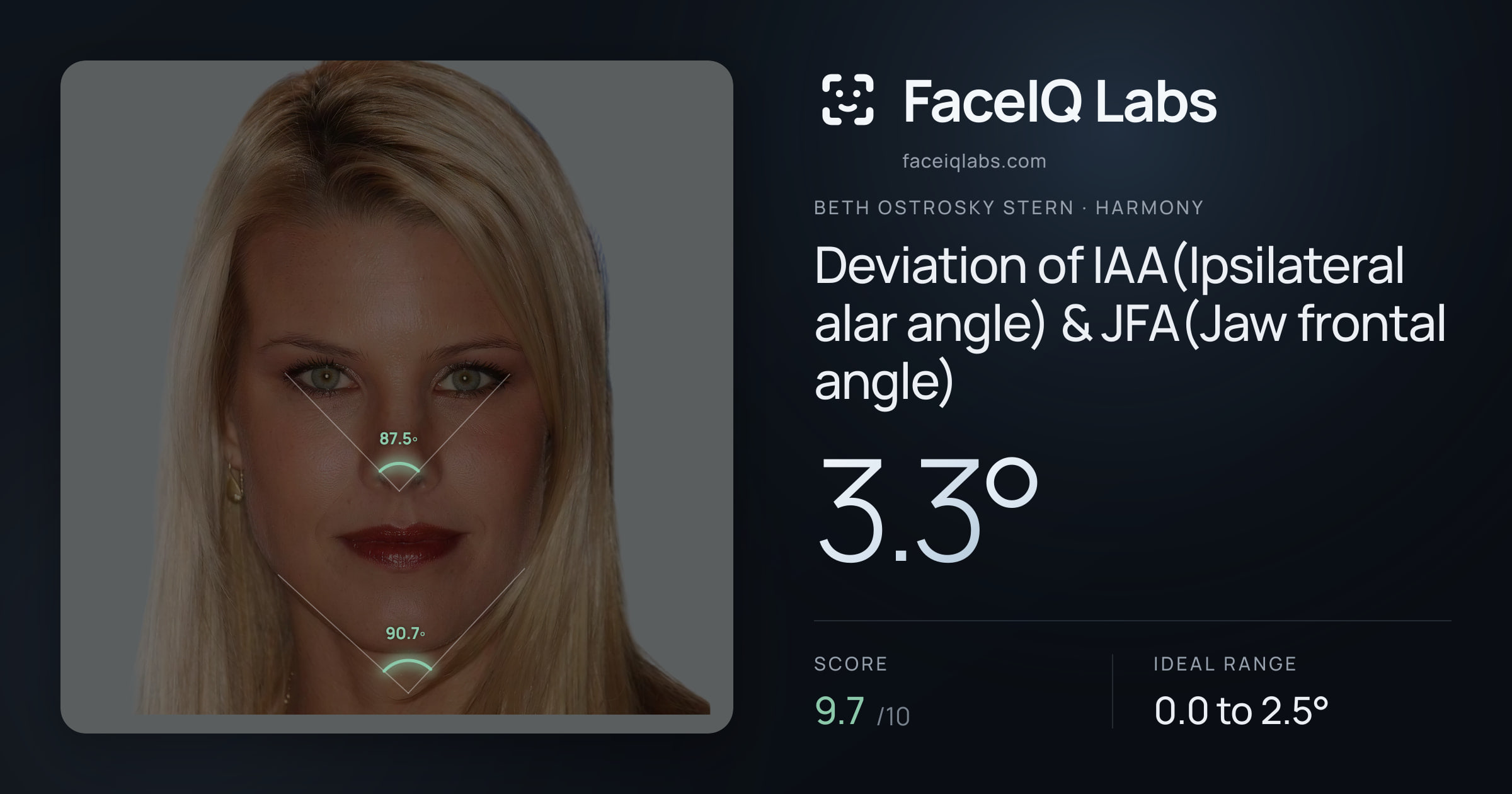 Beth Ostrosky Stern Deviation of IAA(Ipsilateral alar angle) & JFA(Jaw frontal angle): 3.3°, drawn on the photo