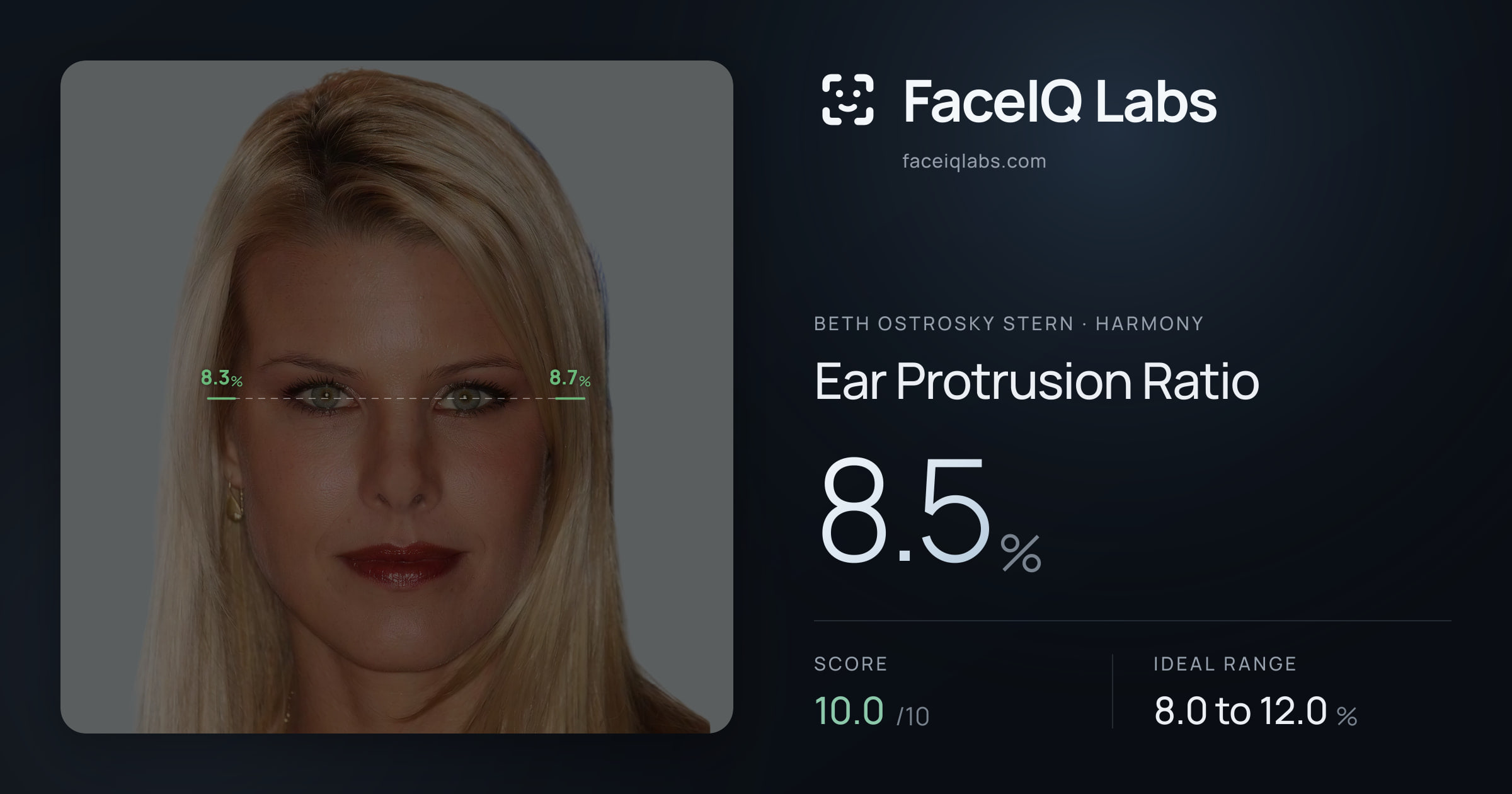 Beth Ostrosky Stern Ear Protrusion Ratio: 8.5%, drawn on the photo
