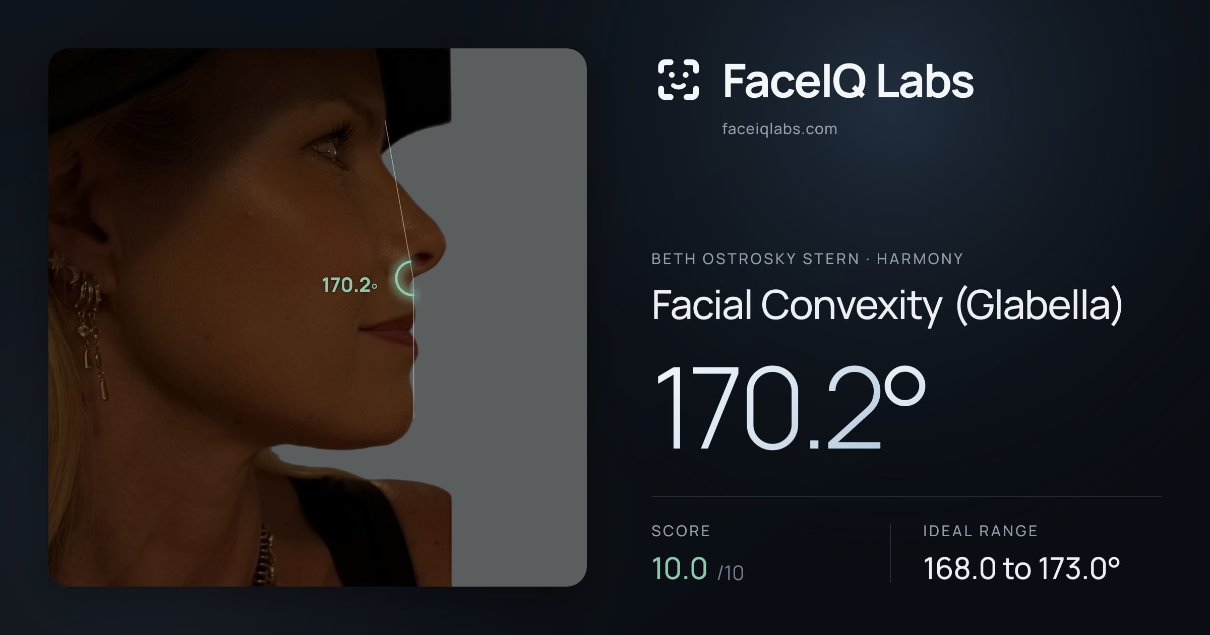 Beth Ostrosky Stern Facial Convexity (Glabella): 170.2°, drawn on the photo