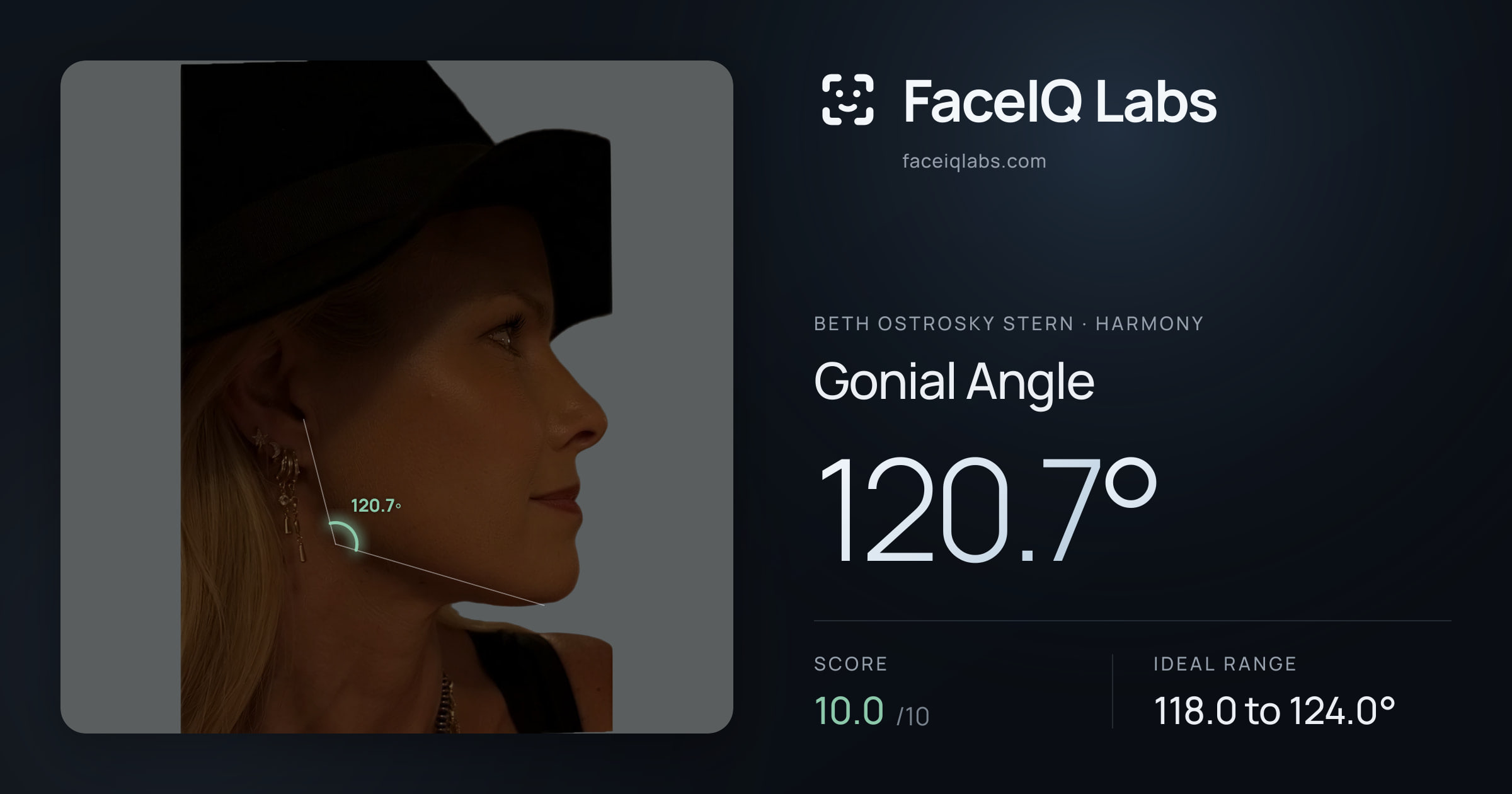 Beth Ostrosky Stern Gonial Angle: 120.7°, drawn on the photo