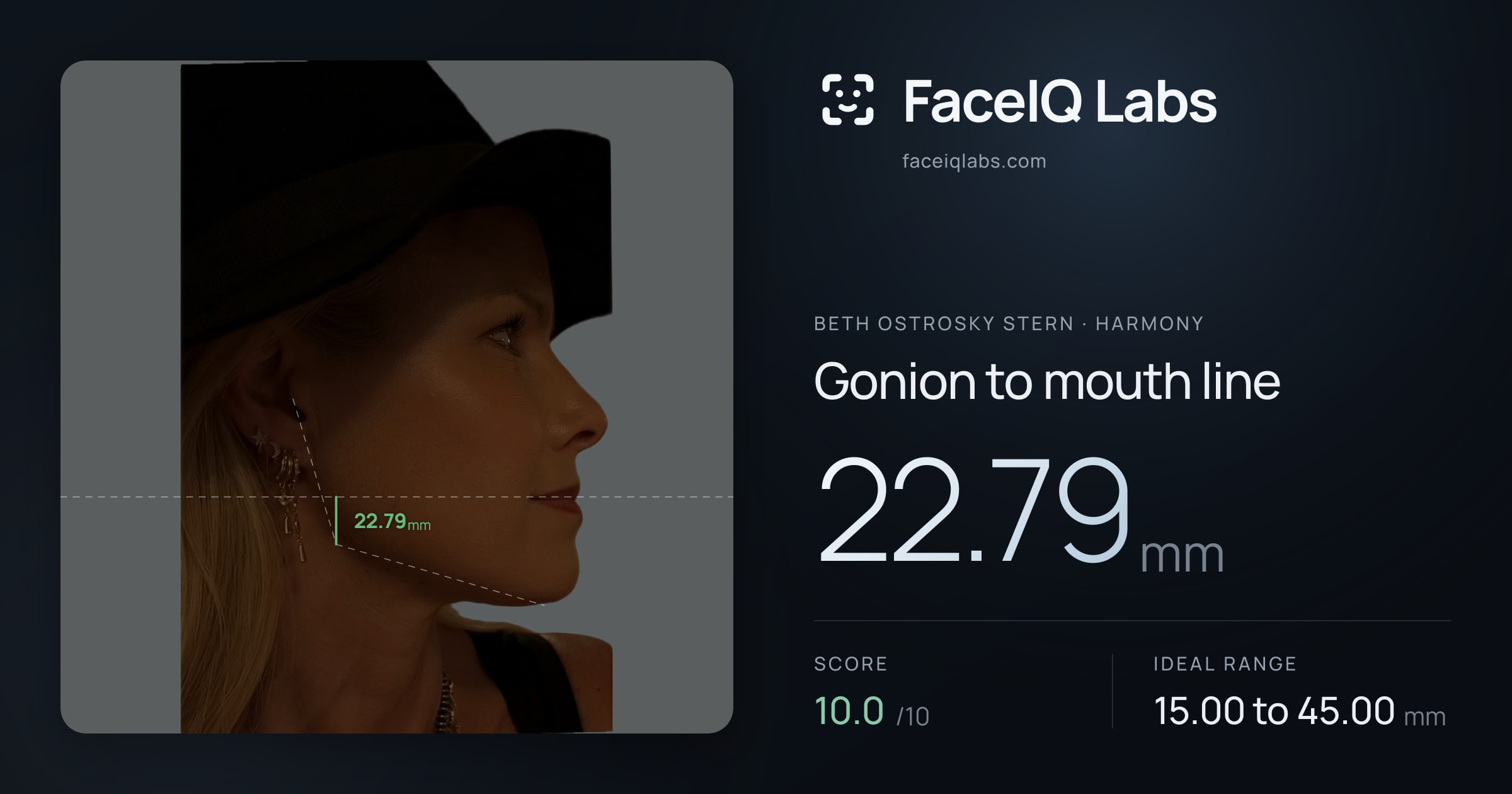Beth Ostrosky Stern Gonion to mouth line: 22.79mm, drawn on the photo