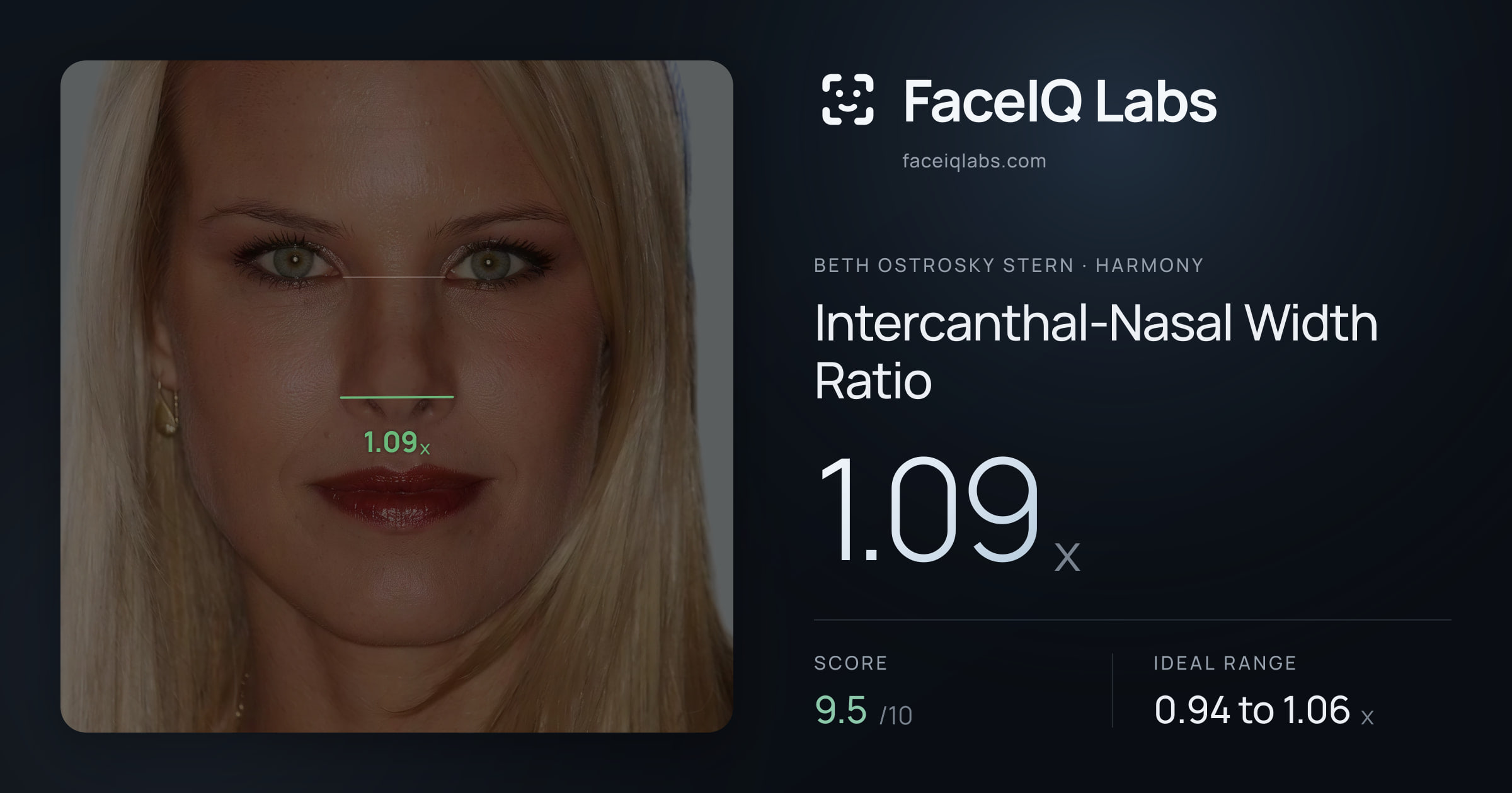 Beth Ostrosky Stern Intercanthal-Nasal Width Ratio: 1.09x, drawn on the photo