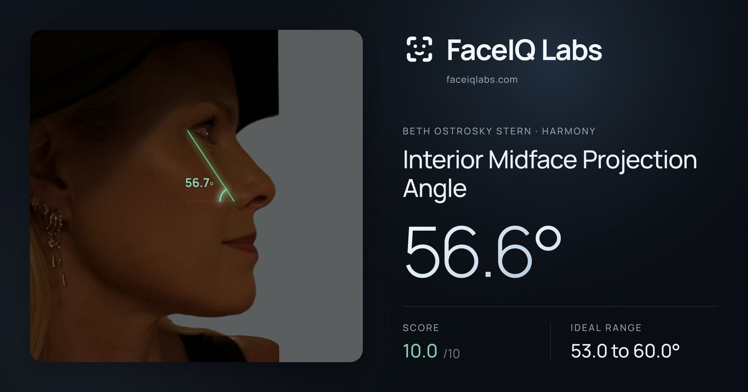 Beth Ostrosky Stern Interior Midface Projection Angle: 56.6°, drawn on the photo