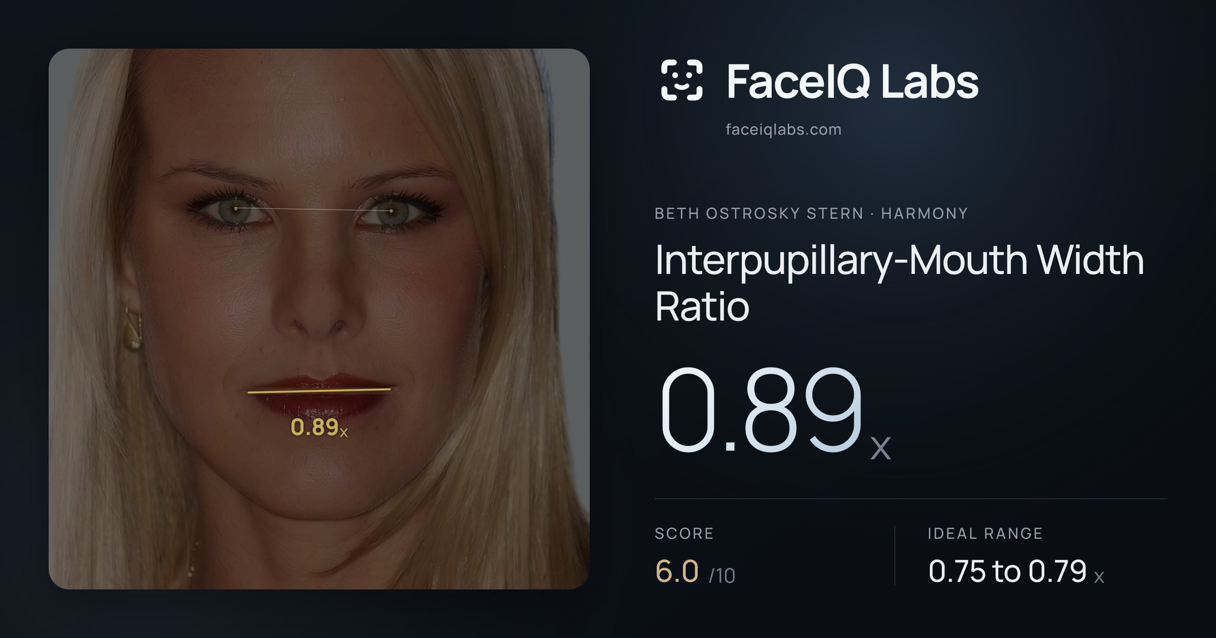 Beth Ostrosky Stern Interpupillary-Mouth Width Ratio: 0.89x, drawn on the photo