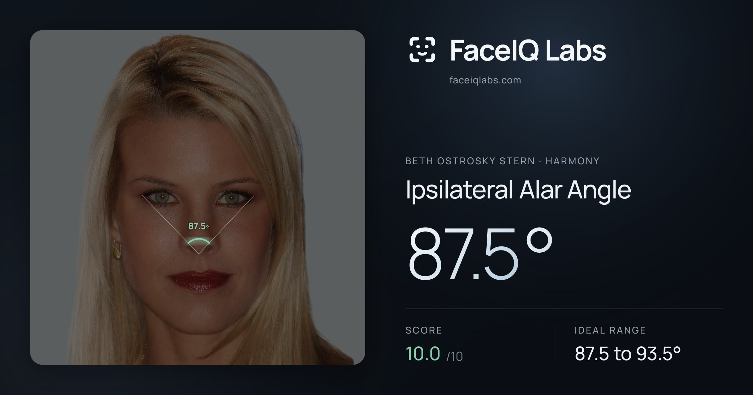 Beth Ostrosky Stern Ipsilateral Alar Angle: 87.5°, drawn on the photo