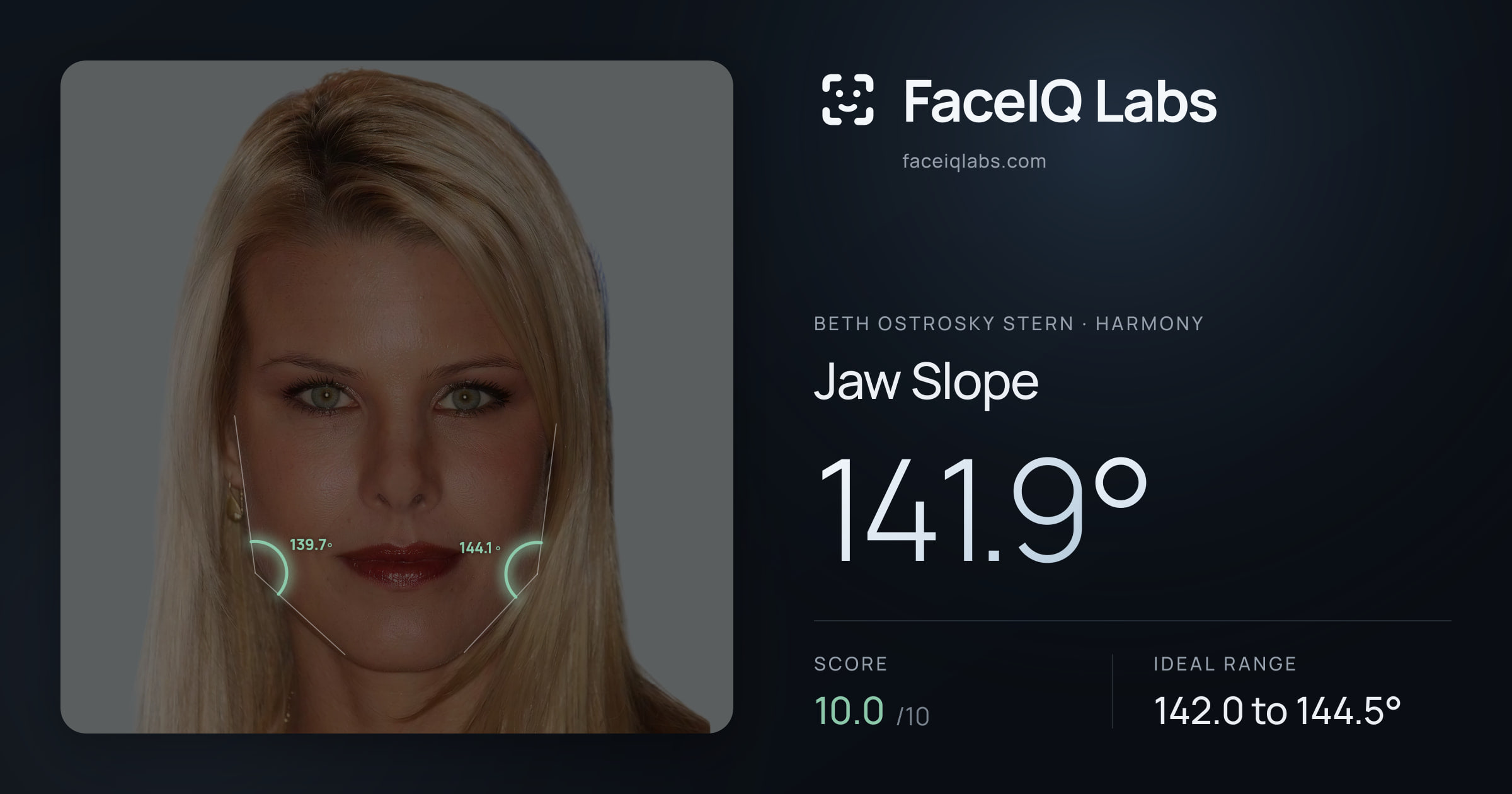 Beth Ostrosky Stern Jaw Slope: 141.9°, drawn on the photo