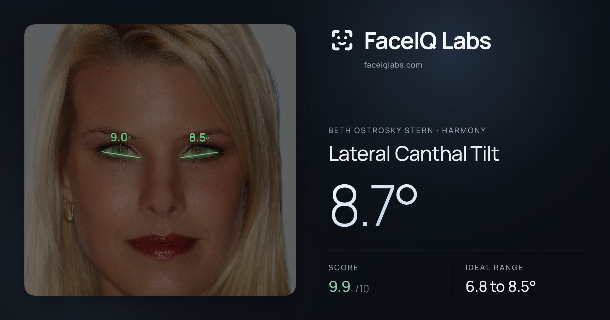Beth Ostrosky Stern Lateral Canthal Tilt: 8.7°, drawn on the photo
