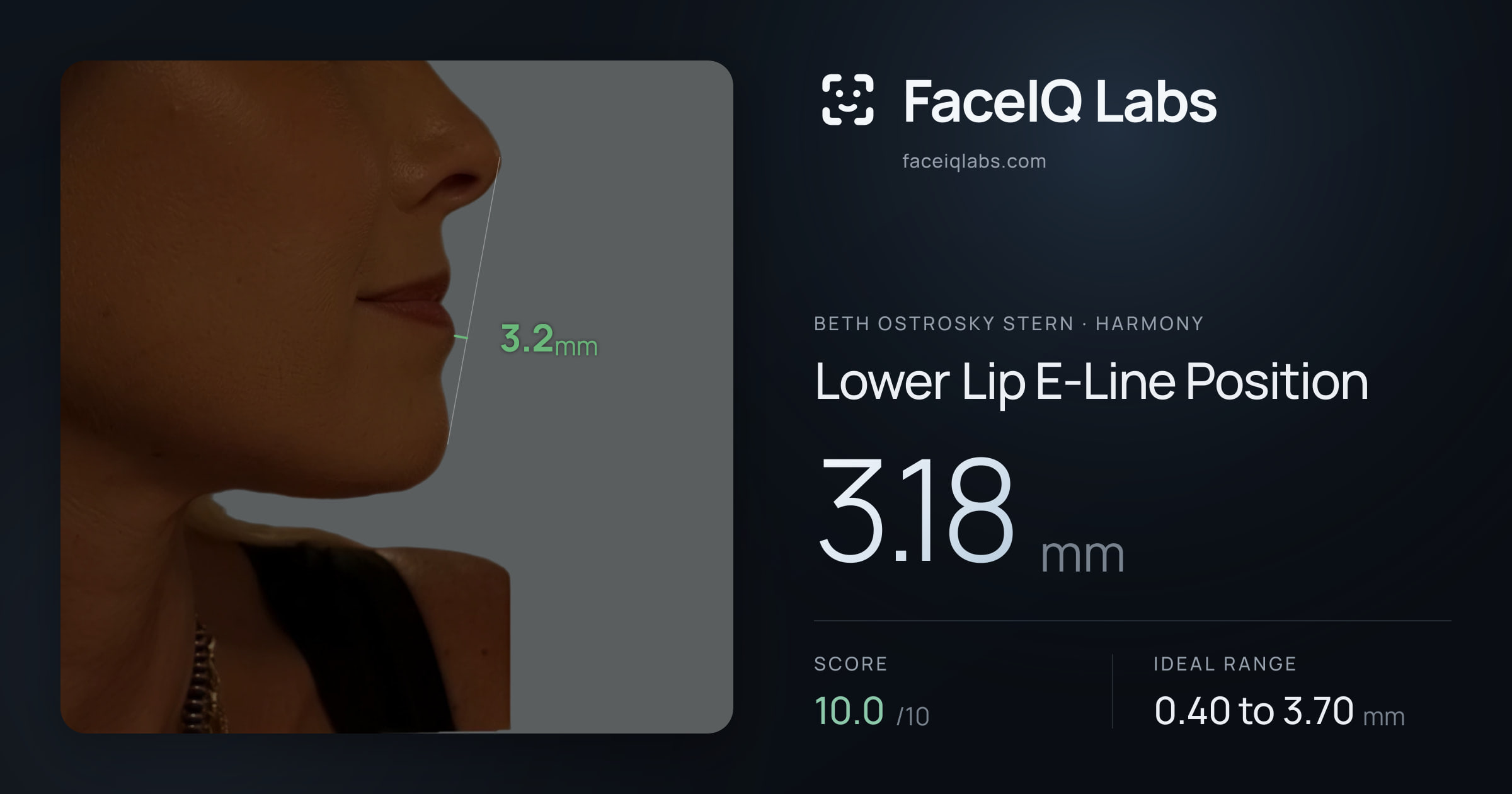 Beth Ostrosky Stern Lower Lip E-Line Position: 3.18mm, drawn on the photo