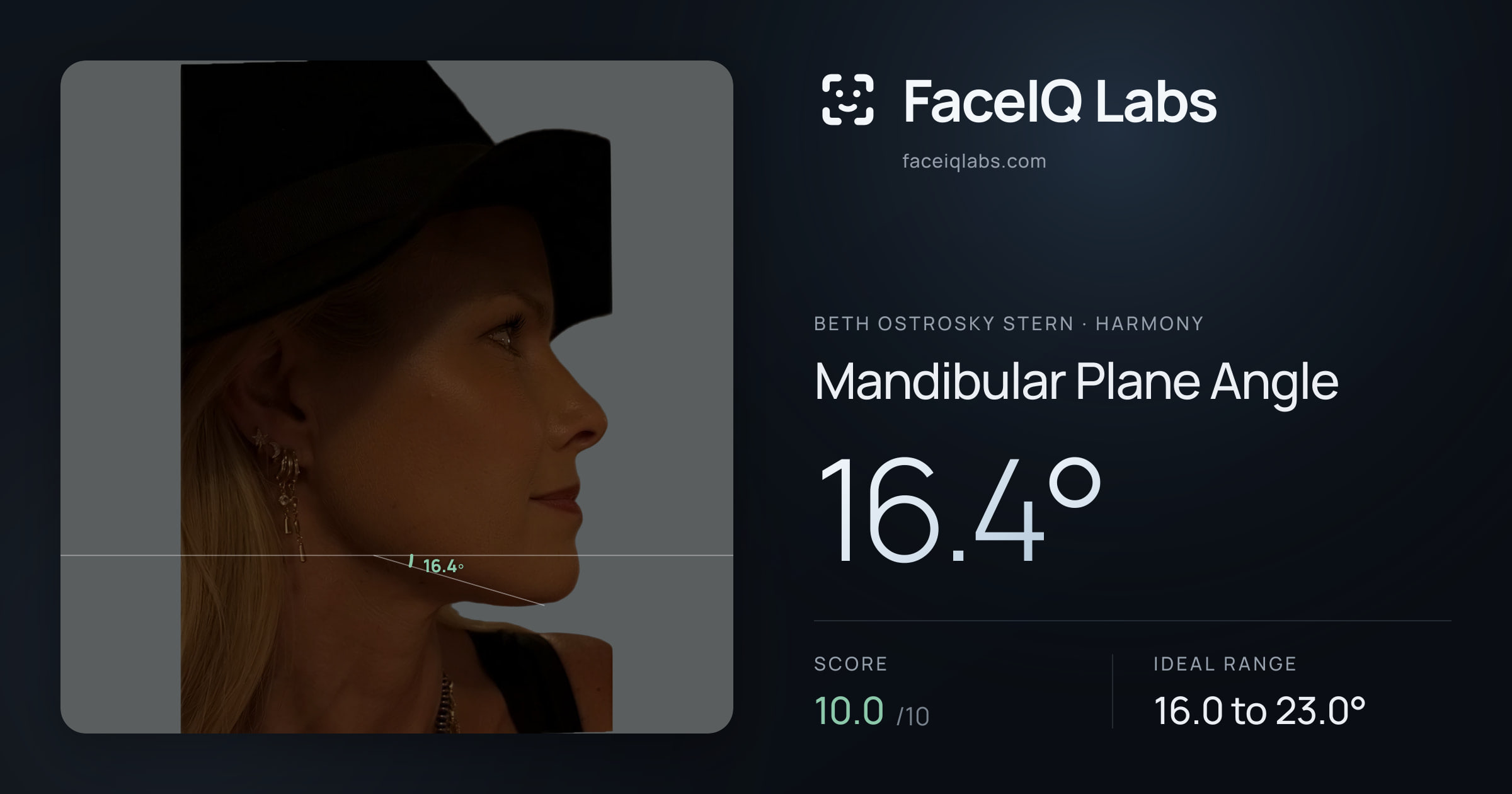 Beth Ostrosky Stern Mandibular Plane Angle: 16.4°, drawn on the photo